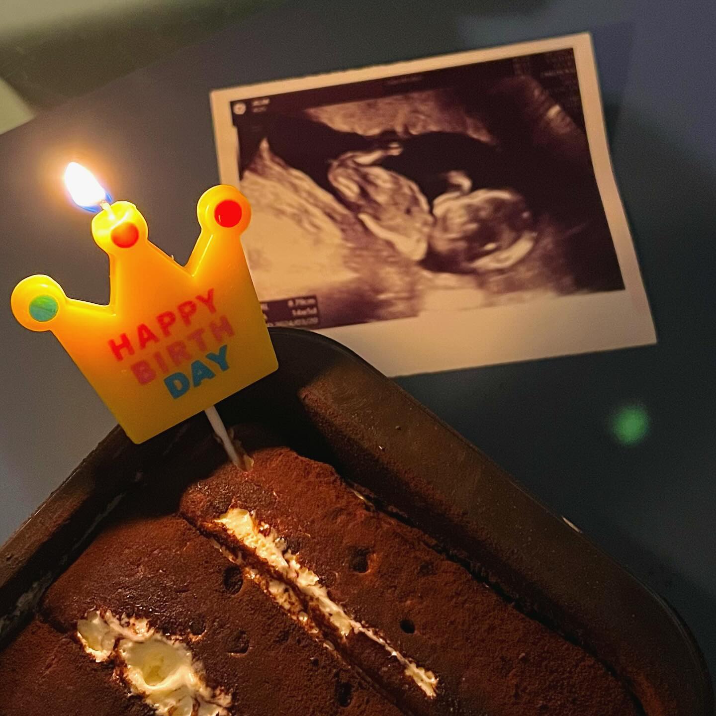 🎉 오늘 생일은 오빠랑 둘이 보내는
마지막 생일 😭
.
🤰🏻 16주차에 들어서는 봄이🌷 도
함께 보내는 행복한 생일날
.
몸은 힘들지만 더더욱 행복해질
내년 생일 기대됨✨
.
생일 축하해 주신 분들
모두 다~ 감사하고 💖합니당
.
#생일 #1003 #임밍아웃
#임신16주 #축하해 #생일축하
#birthday #초음파사진