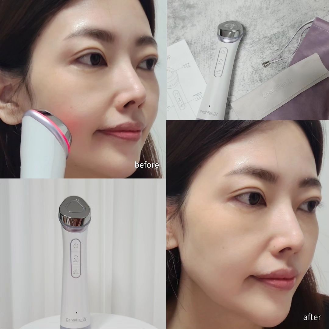 #협찬 

centellian24

춥고 건조한 날씨에
얼굴이 당기고 꾸준한 홈케어기기가 필요해서
이보영마데카프라림으로 관리해주었어요👋

저 같은 귀차니스트도
2주동안 매일 사용가능할 정도로
사용법도 간단하고
음성안내가 잘되어있고
무게도 가볍고 부담없이 쓸 수 있어요🫰

🌈브라이트닝 모드 -5분케어

🌈흡수 모드 - 5분케어
앰플과 함께 사용하이
깊숙하게 흡수시켜주는 느낌이라
속건조까지 개선되는 느낌이 들더라구요

🌈탄력 모드 - 5분케어
피부 겉탄력,3단 깊이 탄력,얼굴6부위 피부 처짐 개선에
도움을 준다는 인체적용시험결과로 확인할 수 있으며
확실히 눈으로도 느껴졌어요

역시 홈케어 뷰티디바이스는 꾸준히 쓸수록
피부가 점점 좋아지는게 느껴지더라구요

브라이트닝,흡수,탄력
세가지 모두를 하나의 뷰티기기로 
관리 가능한 마데카프라임 추천해요🤍

#마데카프라임 #이보영마데카프라임 #센텔리안24마데카프라임 
#뷰티디바이스 #열굴마사지기기 #얼굴케어 #피부미용기기추천
#피부마사지기 #피부기기 #피부디바이스 #피부홈케어 #홈디바이스 #홈케어피부관리기 #동국제약마데카프라임#물광피부