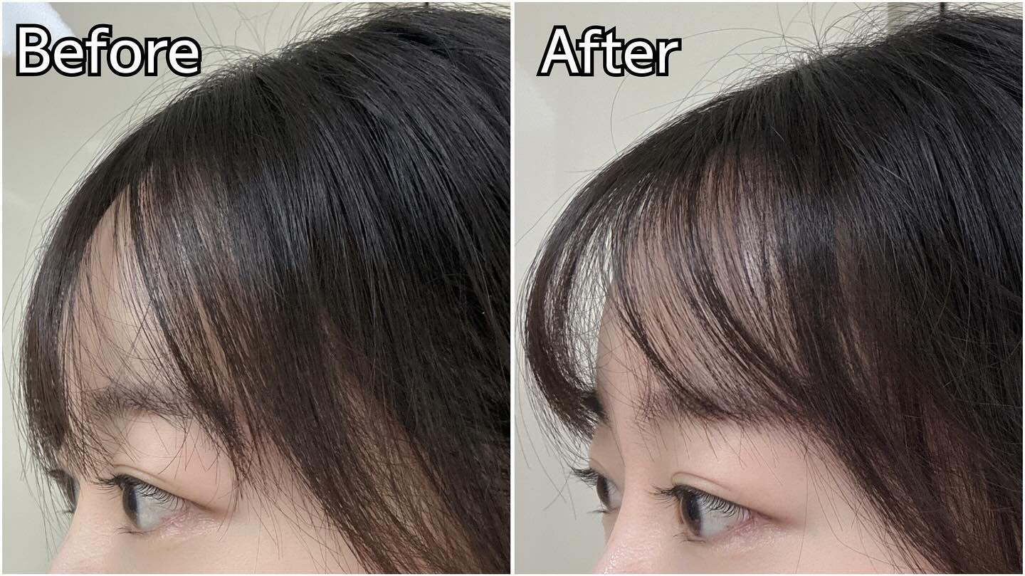 #협찬 

ꔛ 앞머리 고정력 좋은 제품 많이 사용해봤는데 
  정직한실험실 헤어스프레이는 단돈 3천원으로 고정 완료!

ꔛ 모발에 뭉침없이 분사된 가벼운 워터 제형으로, 빠르게 고정 완료

ꔛ 하루 24시간 지나도 유지력 또한 우수해서 엄청 자주 사용해요!

ꔛ 앞머리 뿐만 아니라, 애교머리 스타일링까지 가능!

ꔛ 단순한 스프레이가 아니라 모발 영양 케어 특허 성분 
  22가지 아미노산 성분 함유, 11가지 펩타이드 성분 함유까지!

ꔛ 냄새까지 좋아서 뿌리는데에 전혀 거부감이 없는 제품!
 앞머리 제품 다양하게 사용해봤는데 만족하면서 사용중이랍니다:3🤍 

.
.
.
.
#협찬 #정직한실험실 #트루랩 #헤어볼류머 #볼륨미스트 #헤어픽서 #앞머리픽서 #다이소뷰티 #다이소화장품 #다이소헤어템 #다이소추천템 #다이소헤어픽서 #다이소신제품 #다이소뷰티추천템 #다이소가성비