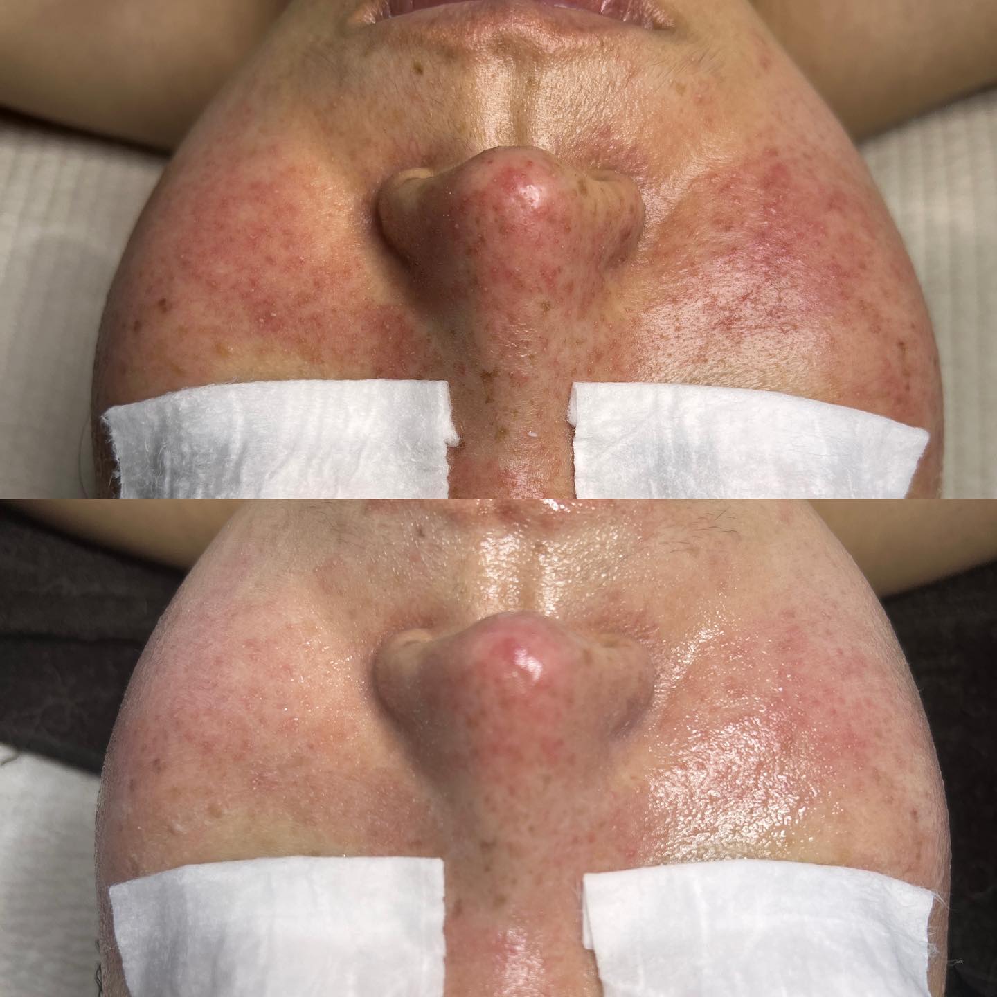 살려주세요!!!
가만히 있기만 해도 따갑고 아픈피부
어떻게 해야할까요?
공장식 관리가 아닌 피부 상태와 고객님의 컨디션에 맞춰 진단하여
과하지도 부족하지도 않은 최적의 관리를 해드립니다.