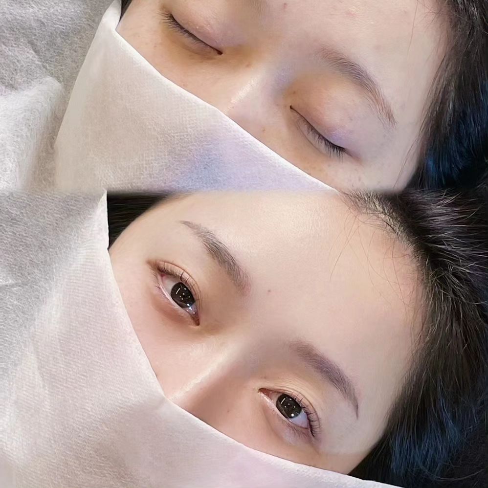 오느른 총명한 눈 획득✨️ #어라운드뷰티
아침 출근준비를 단축하는 가장 빠른 방법 #속눈썹펌

꼼꼼하다는 후기가 줄을 잇는 #능동동탄속눈썹 대표매장답게
원장님 정말 알잘딱깔쎈 🙋‍♀️✨️ 섬세하고 빠른 손으로
단계마다 안심 되는 시술과 적절한 설명 🙇‍♂️ 

부담스럽지 않게 연장 없이 노글루시술!
눈 불편이나 시리는 증상 없는 뷰러 잘 찝은 효과 🫶

재방문 많은 샵은 역시 다르다는 걸 배우고 갑니다 총총총!
토탈샵이라 속눈썹 연장, 눈썹 관리, 왁싱까지 한번에 가능 💕

🍎 동탄 어라운드뷰티 @어라운드뷰티
🍏 경기 화성시 능동 1079-1 

#동탄속눈썹펌 #능동속눈썹펌 #노글루속눈썹펌 #동탄노글루속눈썹펌 #동탄속눈썹펌추천 #동탄속눈썹 #동탄왁싱 #동탄문신