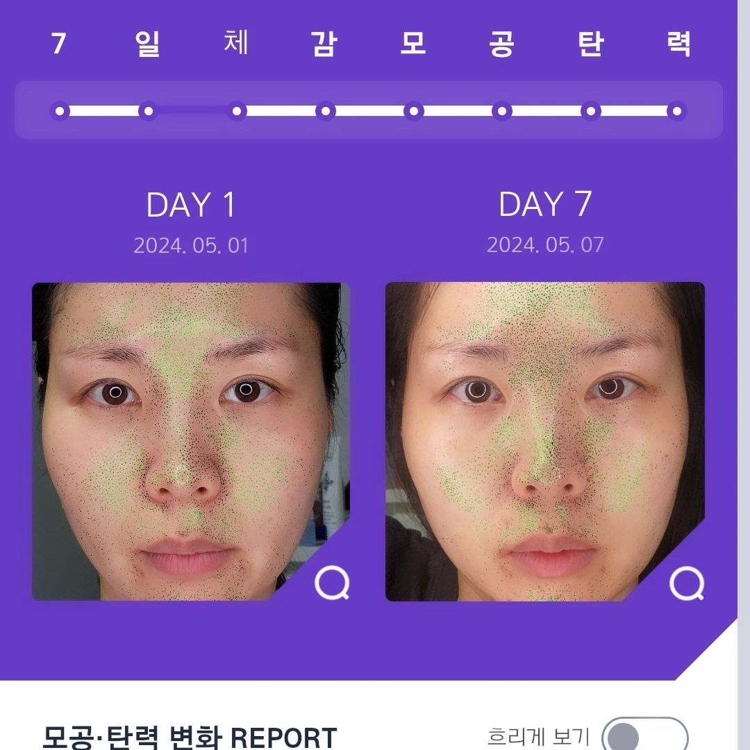 일주일간 피부 변화를 기록하는 #에스트라 #모공탄력챌린지 에스트라 팝업스토어 다녀와서 일주일 동안 사용해봤습니다. 주름은 나이에 비해 적은 편이지만 모공 고민이 컸어요. 어떤 변화가 있을까 궁금해서 기록용으로 남겨봤습니다.

피부장벽과 탄력을 동시에 강화하는 캡슐이 들어있어 쫀쫀하게 속 보습을 채워주는 느낌이 좋았고, 일주일 사용 해 보니 탄력이 붙는 느낌입니다. 특히나 민감성에 홍조 있는 제 피부에도 편안하게 잘 맞았기 때문에 매우 만족하며 사용했어요. 본품 구매할 생각이에요.
#리제덤 #7일체감모공탄력 aestura.official