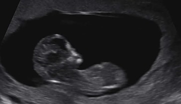 벌써 D-100
이제 정말 얼마 남지 않은 복동이 탄생일.
첫 출산은 조금 늦게 나온다고 하는데 결혼기념일과 겹칠까…안절부절 하면서 명절부터 시작된 초기랑 비슷한 입덧으로 먹토 반복함.
오늘 피검사 전 먹으라고 준 약 토해서 다시 재검해야하지만 주수대로 잘크고 있대서 참 감사할 따름.
엄마랑 올만에 데이트 재검 뜬김에 담주 또 데이트하러 ㄱㄱ 해야지. 
#일상스타그램 #임산부 #엄마와데이트