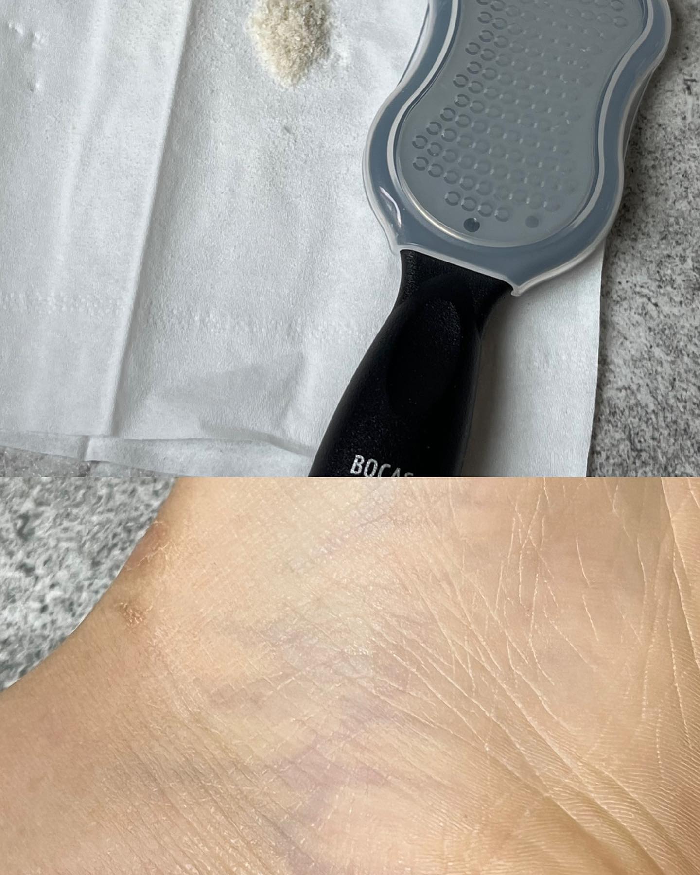 #협찬
BOCAS 일반형 발각질제거기 FC-1000 🦶🏻

⠀⠀
발 각질 관리는 선택 아닌 필수❕
일상 생활 속 크고 작은 자극으로 인해
발에는 각질과 굳은 살이 생기기 쉽다고 한다.

주 1~2회 집에서 풋 케어를 진행해주는 것만으로
깔끔하면서도 건강한 발을 유지할 수 있다는 점 (•̀ᴗ•́)و ̑̑ 
다양한 모델 중 일반형 발각질제거기를 만나 보았다.

특허 받은 234개 초미세 안전날이 부착되어 있어
안전하고 또 더 시원하게 각질을 케어하는 보카스!

이전 사용하던 제품은 발을 따뜻한 물에 먼저 불리고
불어난 각질들을 밀어내며 제거해주는 방식이었다면,
보카스는 맨발에도 바로 사용할 수 있다는 장점이 있다🦶🏻
또 그전보다 시원함의 정도가 달라 더더욱 시원하다 :)

고강도 스테인리스 소재가 사용되어
제거 후 물세척으로 위생적인 관리까지💧

보카스 공식몰을 통해 구매하면
CS와 A/S도 받을 수 있다고 함 (*˘︶˘*).｡.:*♡ 
bocas_o.fficial 

⠀⠀ 
-
Copyright 2024. 𝐦𝐚𝐧𝐧𝐲𝐚𝐦𝐨𝐨
All rights reserved.

#보카스 #발각질제거기 #발각질 #각질제거기
#굳은살 #굳은살제거 #풋케어 #풋파일