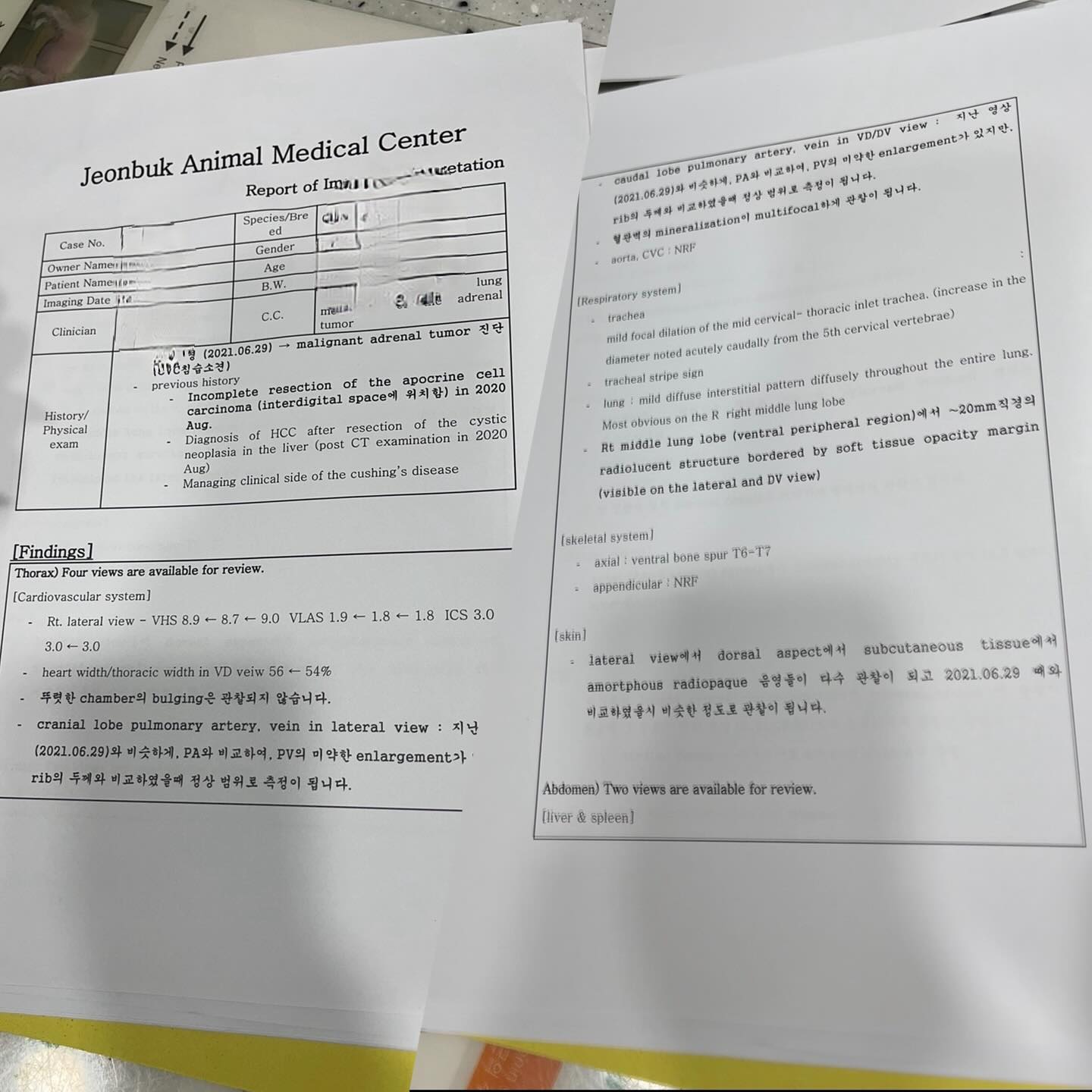사진수정때문에 피드 다시올리기. .
중요한사진 빠져서 우짤수없었음 
역시잠올때 피드올리면 실수가많어. . 

가끔 우리 김치가 사람이였다면 고칠수없었을까 생각을한다.
그정도로 돈을 들이붙고 전국다돌아다녔는데 그랬을까. .
사람이였다면 적어도 정확히 김치가 가지고있던 변명정돈
정확히 이름정도 질병에 수정도는 파악할수있지않았을까싶다.

동물에 의학이 뎌디발전하는건 치료를 포기하는 견주들이많은탓일까
아님 아이들에게.큰돈을 쓰기싫어하는 보호자들의 탓일까
적어도 내주변에는 대출을받아서라도 아이살리려는 보호자가 가득인데

간종양터진시점으로 간엽절제술하고 20년도부터 22년초까지
3개월 텀으로 계속찍었던 ct
추적관찰하면서 갈색세포종 부신종양 대정맥침습 알게되고 
침습정도 알아보려고 21년도 11월 ct에서 갑자기 나타난 뇌하수체종양

다들 보여주지않던 자료들을 참많이 공개해주시고
하나하사 설명해주신 고마우신 선생님들덕에 다가질수있던자료들

contrast enhancement (portal phase)에서 large intensely
enhancina pitutary mass가 관찰이 됩니다. 
(portal phase Ho 100~150

부신의 peripheral rim enhancement on arterial phase와
heterogeneous contrast enhancement within the parenchyma on the
arterial & portal phase 와 Cvc를 침범하고 있는 양상을 고려하면, 종양의 가능성이 있고 악성도의 가능성이 크게 고려됩니다.
- CVC를 침범하고 있는 양상이 관찰되는 이상, 혈관을 통해 metastasis가 가능합니다. 칸의 thrombosis를 일으킬 수도 있고, 심장의 RA에 이르러 전신으로 metastasis 또한 가능합니다. 현재로서 그러한 소련은 뚜렷하게 관찰되지 않습니다.
- 지난 영상과 마찬가지로, Pituitary가 contrast enhance된 점을 고려하면 malignant adrenal tumor와 PDH가 함께 있을 가능성이 높게 제시됩니다.

대부분 양성이라고하지만 그대부분을 늘 김치는 비켜갔고
그착한 암이라던 피지샘종양도 악성
편측만있더도 도전해볼만 부신제거수술도 불가능한 양측비대 cvc 라 방사선도 불가
비기능성 단순 고통없는 뇌하수체 종양이라고 보호자님들은 그렇게 이야기했다.
 
김치가 한달후에 얼굴에 틱이나왔고 한달후에.눈을못떳고 
또한달후에 눈가쪽이.부었고 뇌압이 올라갓것마샹 뒷통수가 탕탕해졌교
그러면서.두통이있는 잠시도 못눕고 비명을 질렀다.
모두 뇌하수체 거대선종의 증상이였다. 
가기직전에는 중추신경까지 눌려 
두시간에 한번씩 밥을먹으려고 내손까지먹으려는 
이상식욕도왔다.

그런데도 그 시작의 쿠싱은 늘 오리무중이였다. 
정말 갈색세포종이였나
약측비대 cvc였는데
시작이 의인성은 맞았었나
뇌하수체거대화라면 거대선종이였을까?
그때 뇌하수체라도 방사선했다면 그래도 괜찮았은까?

엄마다. . 
여전히 아이혈검자료 ct자료 영상 엑스레이 검사자료 소견서
아무것도 버리지도못하고 아이질병관련된것밀봐도
여전히 집중하고보게된다.
이제는 안봐도되고 신경 안써도되지만 그래도 그게안된다.
여전히 아이에 질병에서 헤매고 다닌다. 
이런다고 김치가 살아오는것도 아니지만서도

얼굴땡땡붙고 눈도못뜨고 아프다고울던너
기절하고깨어나서 힘들어서 몇시간 누워있던너

이유는 변명은 왜그런지는. . 알아야 너한테 뭐라도말해줄텐데

시간이지나서 수의학계가 더더 발전이되면
어떤선생님께라도 김치 3년자료 영상 혈검 이자료들을 내밀면
누군가는 정확히 말해주실수있으려나. .
그날이 빨리왔음좋겠다. .질문에 답을 누구든지해주실날이 

#문듸
#널생각하다가