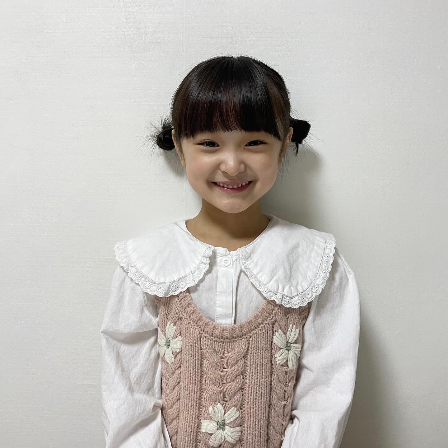 ⠀⠀⠀⠀⠀⠀⠀⠀⠀⠀⠀⠀
그냥 양갈래로 묶으면 머리카락이 삐죽빼죽
너무 장꾸같아서 똥머리로 해줬더니 맨날 이렇게 해달래ㅋㅋ
두개 빠진 아랫니도 드디어 나오기 시작!
앞니 빠지면 얼마나 못생겨질까..벌써부터 걱정이네?🌝