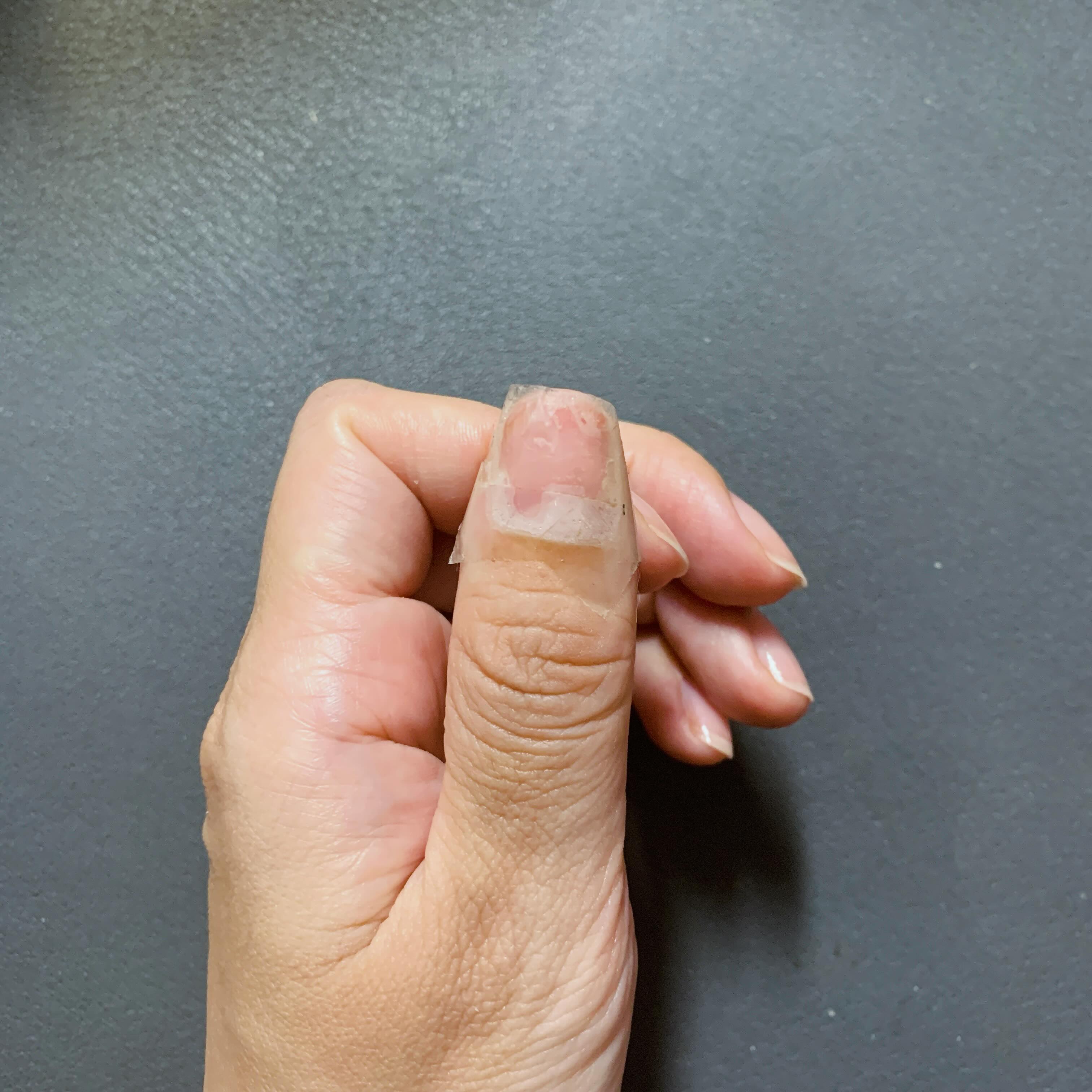 ⠀⠀⠀⠀⠀⠀⠀⠀⠀⠀⠀⠀ ⠀⠀⠀⠀⠀⠀⠀⠀⠀⠀⠀⠀ ⠀⠀⠀⠀⠀⠀⠀
어깨수술때문에 네일 지워야한다해서 지웠는데,
세달전에 초짜 네일샵에서 손톱했다가 아작나서
조금만 부딪쳐도 찢어짐.
급한대로 테이프로 칭칭...
슬프다.😭
-
-
-
-
#생손톱 #네일시급함 #손톱 #전문가의필요성 #일상 #소통