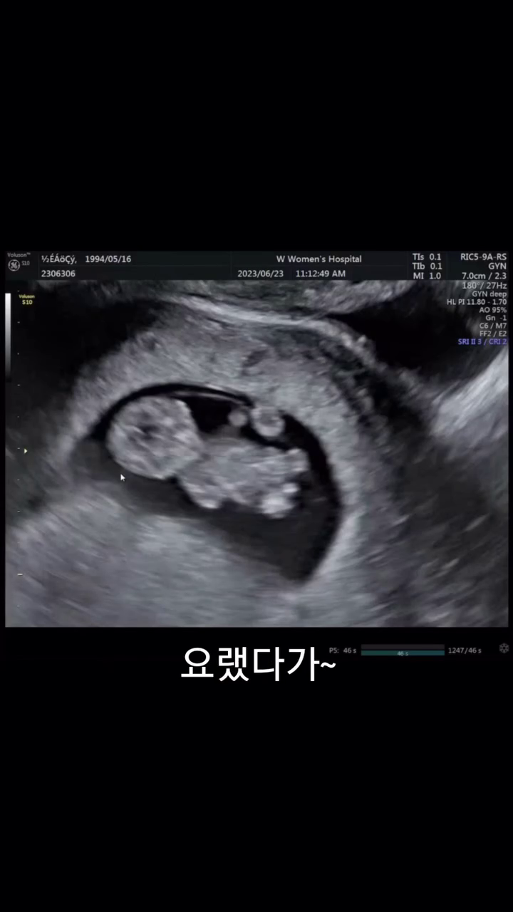 우리 아들 이랬는데 요랬다가
오늘 태어났어요~~~
뭐라고 표현이 안되는 감정
사랑한다
우리지혜 진통만 17시간 자연분만 한다고
고생했어 사랑해

#아들 #아빠 #천사 #사랑 #가족