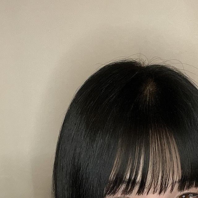 김혜미 on Instagram: "#협찬 건성피부 인지라 트러블이 잘안나는 편 이지만 연중행사로 왕뾰루지가..ㅜ 미리미리 방지했어야 하는데 아차싶죠 이제라도 꺼내보는 메디큐브 ‘레드 석시닉 애씨