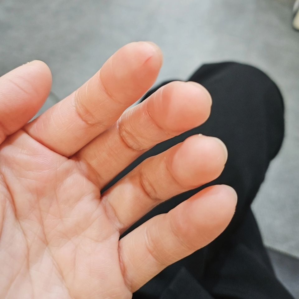 요리한답시구채칼에 손더가걸람🥲
와서 파상풍주사를맞아야하나ㅠㅠ튱튱부어오는중
불쌍한내손ㅠ낼 예약즐 취소되길🙏
#워킹맘#n잡러#복길아#복길이네샵