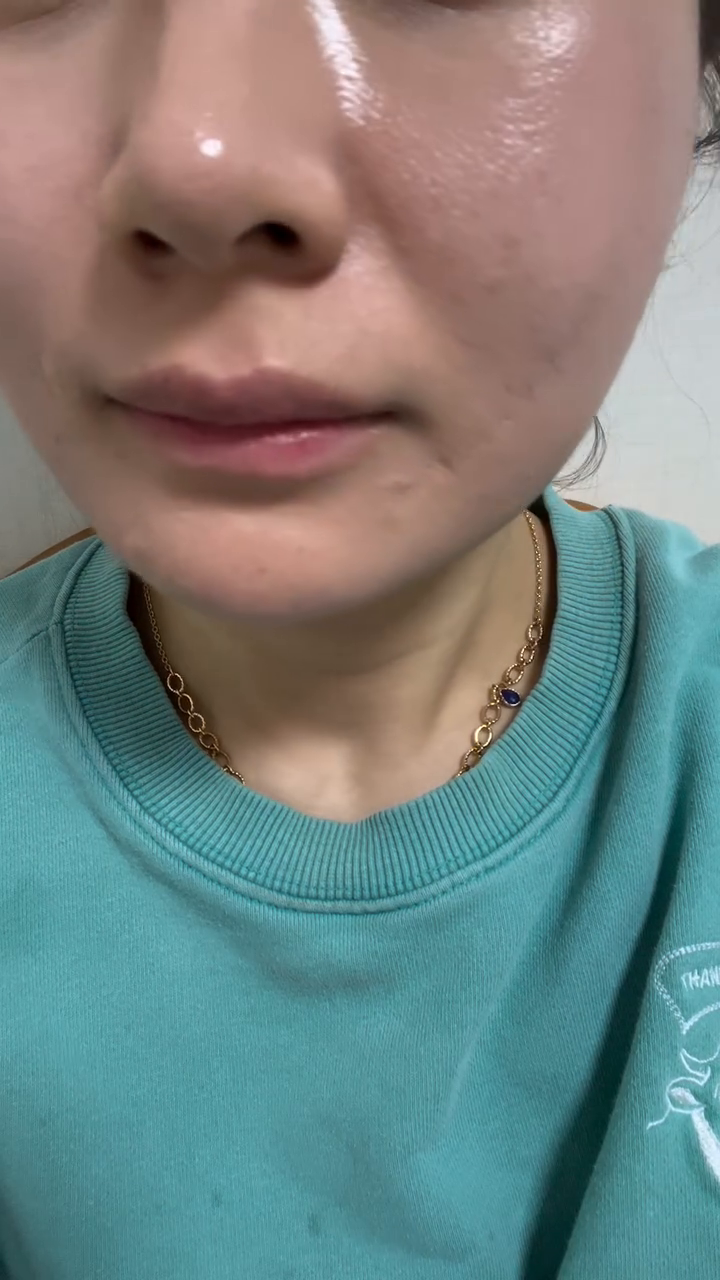 아무것도 안 바른 쌩얼 
쌩 카메라 촬영
하루종일 밖에 있어 
얼굴에 홍조 올라옴😭
필터 1도 x 좋지 않은 피부지만
1회 관리만으로 찐 속광을 찾을 수 있음.

#천안피부관리 #협찬 #안젤리피부관리샵 #쌍용동피부관리 #불당동피부관리 

피부관리를 일주일에 한번씩 다양한 곳에서
받아봤지만 여기처럼 찐 효과가 나는 곳은 없다. 

💡1회 가격이 비싼건 사실 1회만으로 얼굴 윤곽과 속광이 제대로 난다. 
💡모두 일회용 제품 모든 제품이 수입산 고급 제품
💡1회관리 2시간반-3시간 기본
💡채워주는 필 + 윤곽 임플란트 
No경락  But 확실한 비대칭 잡음
💡씨앗마스크로 건조 싹 잡음

30회권 끊어서 등관리 얼굴관리해봤자
30회 끝나면 얼굴에서 나타나는 효과가 없다. 
확실하게 10회로 2-3년 관리 안해도 속광이 나는 찐 케어를
해주는 곳은 진짜 여기밖에 없음
8년 전에 한번 방문.  4년전에 재방. 오늘 또 재방
이곳 관리 못 잊어 다시 찾게됨. 

10회 관리로 앞으로 2-3년은 피부샵과 빠이빠이 할 수 있는
진정한 샵 추천해요.