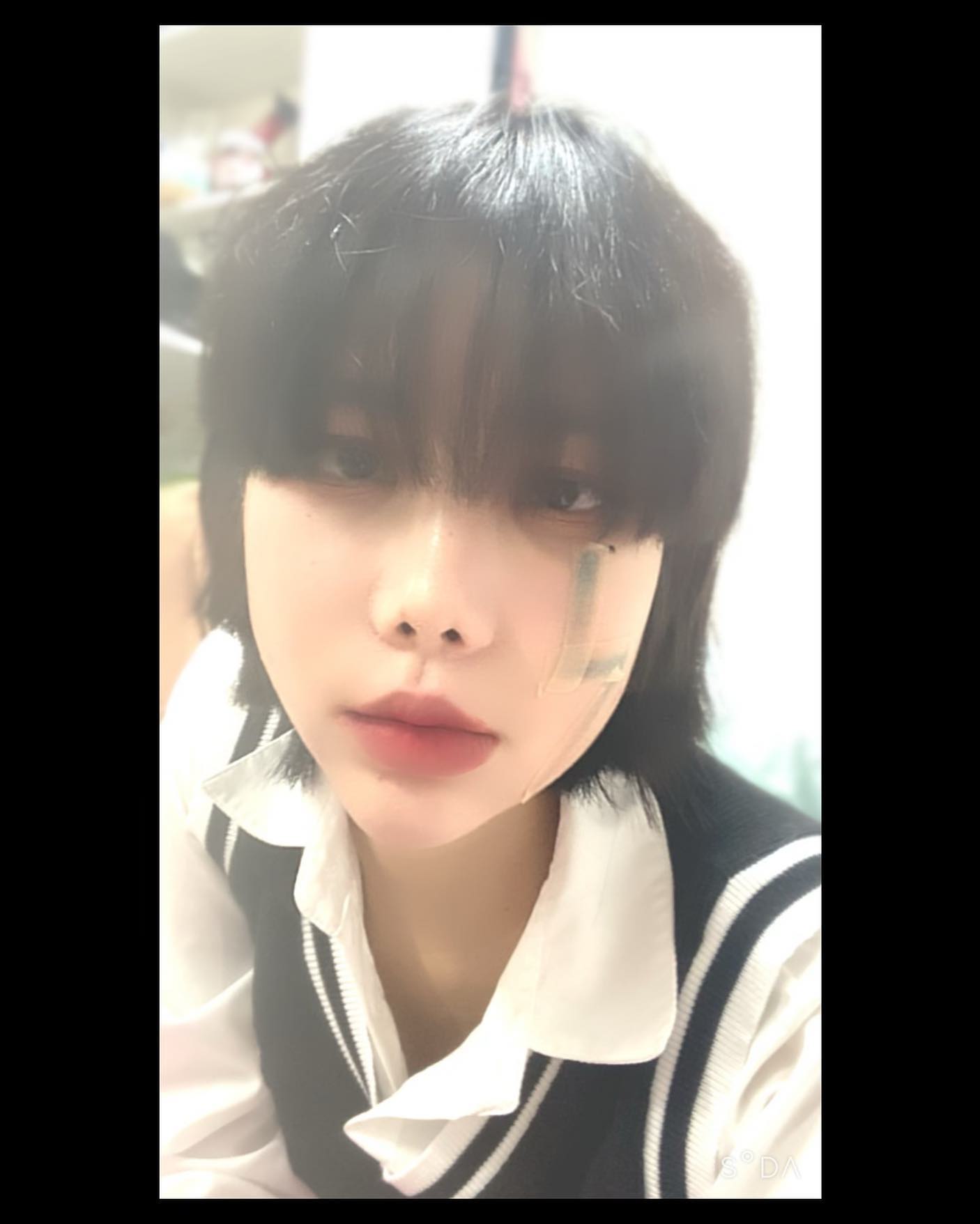 문신지우기!