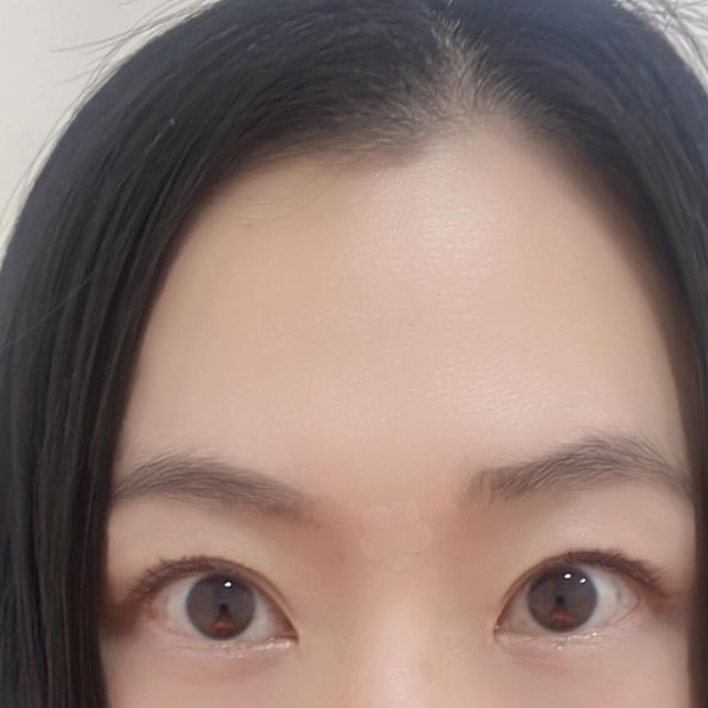  리뷰쥬쥬 | 홍지유 on Instagram: "오직 발침술로만 안면 비대칭교정 되는 거 아세요~?! 
심지어 팔자교정, 볼살빵빵! 눈매교정까지 된대요 🤍 

ㄹㅇ! 찐! 🦶🏻발바닥에 침만 맞는데, 넘 신기하잖아요~!! 

뭐- 제가 워낙 성형이나 시술을 안좋아해서 더 끌렸지만, 
사실 타고난듯 자연스러운거 다들 원하는거 아닌가요? 

예쁘고 친절하신 미모의 이사님이 주시는 따끈한 한방차 마시며
훈내 폴폴 - 원장님의 발침술 손맛 느끼며 60분간 푹- 쉬고 나면
매일 매일 더- 예뻐질 수 있어요 🤍 

저는 총 20회 등록했고요. 
지금까지 5회차 관리했고, 
앞으로 15회차 남았어요! 

5회차만으로도 볼살이 차오르는게 느껴진답니다. 힛! 

🏷️ 관리 꾸르팁 : 
혹시 제 인친 중에 하실분들은 @jayeonsan_gracis_official  문의하시고 가서 리뷰쥬쥬 또는 홍지유 말씀하시면, 진행중인 이벤트 할인가 + 30% 해주신대요. (ex : 🧮 이벤트 20% + 쥬쥬 할인 30%)"