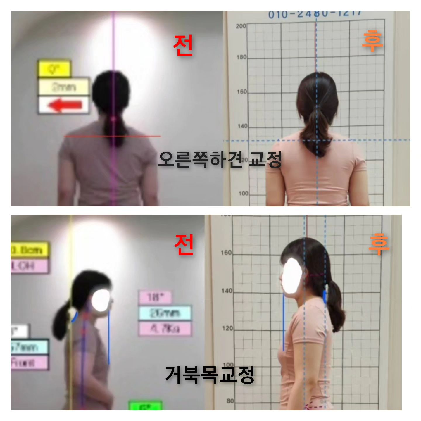 ⠀
출산후 독박육아로
시간을 쪼개서 운동하시던 회원님🥲
⠀
주1회 운동나오시다보니
10회 끝내시는데 2달이 넘게 걸리셨었는데요😶
주1회 나오시는대신 
매일 제가 안내드리는 스트레칭과
홈트레이닝 병행하신결과
(거의 하루도 거르지않고
운동영상 보내주셨답니다)
전방경사 개선 및 거북목개선
심했던 우측 하견까지 개선되셨답니다🙂
⠀
저한테는 개인레슨의 체형개선에는
뭐가 중요한지 다시 일깨워주신 회원님이세요
⠀
몸은 거짓말을 못 한답니다🙂
⠀

#원주필라테스 #원주그룹필라테스 #원주헬스장 #원주피티 #원주pt  #원주개인필라테스 #무실동필라테스 #무실동헬스 #무실동pt #원주다이어트