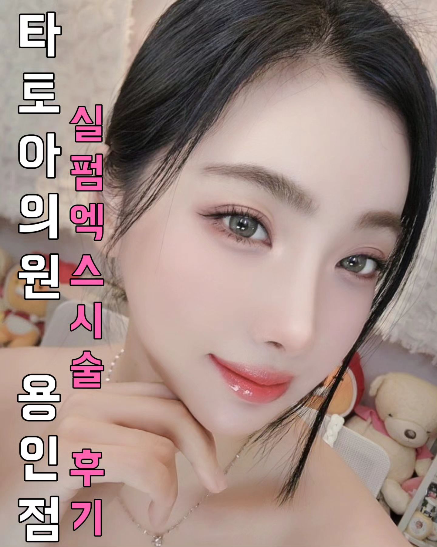 실펌엑스는 피부 층별로 시술 가능한 고주파 시술이라고 합니다🤗
마취크림 바르는 시간이 조금 오래걸리는데 시술시간은 5분정도 걸리는 간단한 시술입니다!

시술하는 여러 곳이 있겠지만 저는 타토아의원 용인점에서 김연수 원장님께 시술받았어요😊
시술 전 꼼꼼한 설명과 과잉진료 전혀 없으시고 솔직한 진료와 시술 추천, 그 추천을 통한 적절한 시술을 받아서 엄청난 효과를 봐서 만족을 했고 시술도 편안하게 진행해주셔서 아주 대만족입니다. 

현재 시술 후 10일정도 지난 상태인데요
모공이 확연하게 줄었고 피부결이 정말 좋아져서 아주 만족하고 있습니다🥰

써마지와 같은 효과인 시술이라고하는데 비용은 훨씬 낮아서 부담이 낮아졌어요🙊

피부 잔주름같은 것이 싹 펴지고 탄력도가 정말 좋아졌어요
울쎄라를 4개월 전에 받았는데 즉각적인 피부탄력도와 피부변화의 만족도는 개인적으로는 실펌엑스가 훨씬 높아요💕

시술 직후는 붉고 조금 붓고 시술자국도 좀 남았었어요
시술 다음 날은 붉은기는 없었고 붓기조금과 약간의 시술자국이 남았는데 메이크업으로 다 커버가능한 정도였습니다😊

3일 정도는 피부가 재생이 되는 과정인지 각질로 메이크업이 들뜨긴했는데 일주일 째되니 아기피부처럼 매끈해지면서 화장도 정말 잘 먹더라구요🤭

블랙헤드, 모공, 피부결, 각질, 피부톤에 저는 효과를 정말 많이 봐서 실펌엑스 꾸준히 관리 받아보려고 합니다

실펌엑스는 피부 속 환경개선을 통해 근본적인 피부트러블 해결, 작은 자극에도 튼튼한 건강한 피부로 개선해주고 난치성 기미, 홍조, 잡티, 모공에 효과적이라고하네요💗

저와 같은 피부고민 있으신 분들 타토아의원에서 실펌엑스시술 강력추천드려요!

타토아의원 용인점 tatoa_yongin

#실펌엑스 #민감성피부 #예민한피부 #스킨부스터 #피부재생 #줄기세포 #정맥주사 #항노화 #톤업 #흉터재생 #기미 #홍조 #타토아의원용인점 #타토아의원 #김연수 #김연수원장님