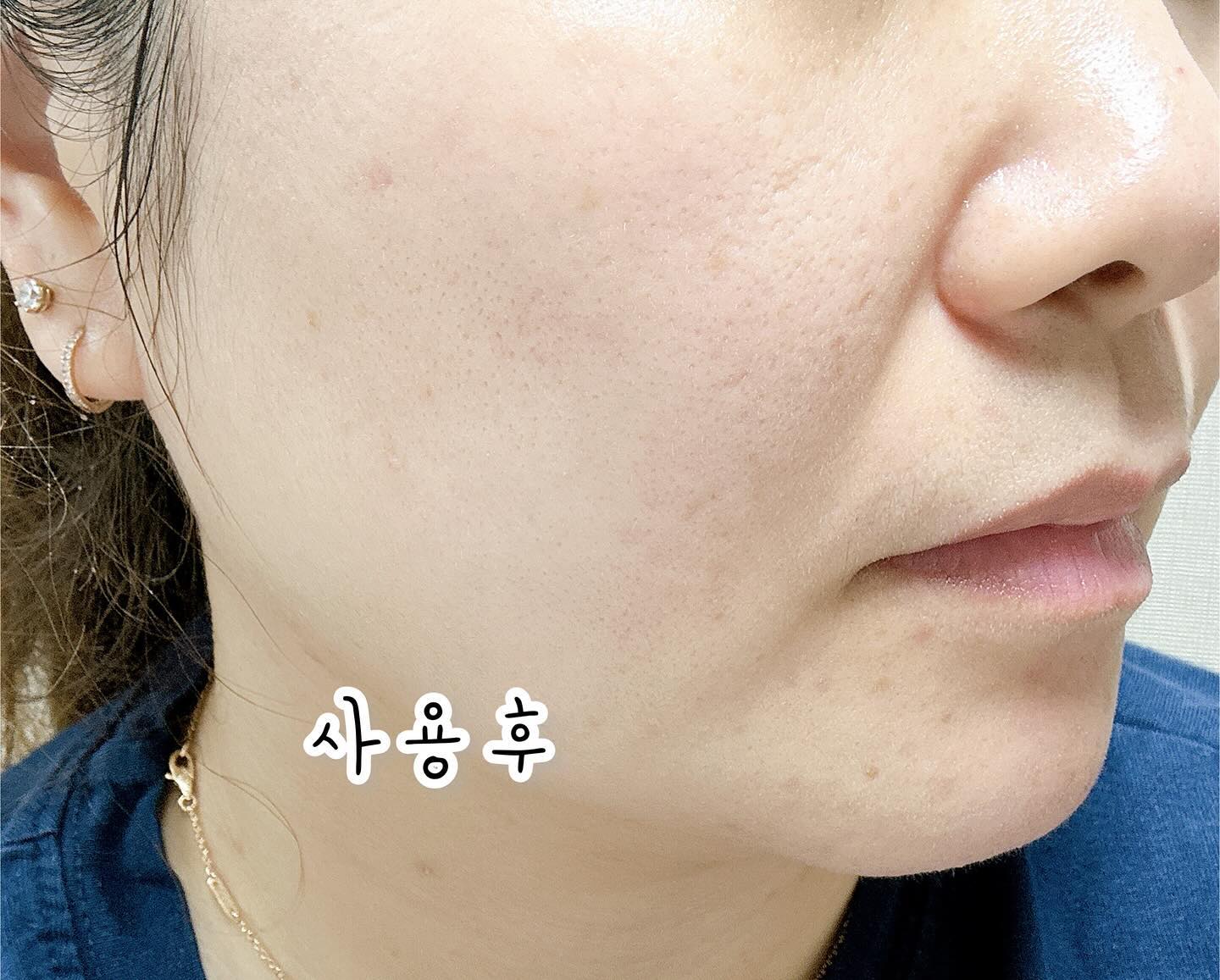 #협찬
-
내 사랑 #달바미스트세럼 1년 365일 매일 사용 중인 제품이에요☺️기존 제품보다 핵심 성분 함량이 업그레이드된 고농축 항산화 세럼!
-
달바 미스트의 핵심 성분이란!! 
이탈리아산 화이트 트러플(흰서양송로추출물) 14,000ppm, 토코페롤 1,300ppm, 비건 단백질 13 COMPLEX 인데요. 보습과 탄력을 한 번에!! 케어 해 줘서 너무너무 좋아요💕
-
아침에 세안 후에 이거 하나만 뿌려줘도 수분감이 촉촉!! 요즘은 날씨가 건조해서 세안 후 피부 당김도 심해졌는데 세안 직후 뿌려주면 건조함이 싹 해결된답니다😆
-
특히 분사 후에 피부에 샥 내려 앉는 느낌이 너무 좋은데요. 마치 이슬이 내려 앉은 듯한!! 입자가 아주 고와서 그런지 피부에 더 잘 스며드는 것 같아요❣️
-
바쁜 아침, 귀찮은 저녁! 미스트, 세럼, 토너, 에센스를 한 번에👍🏻 촉촉 탱탱 탄력과 광채는 덤✨
-
#달바로얄세럼 #세럼추천 #미스트추천 #미스트세럼추천 #달바세럼시즌5 #항산화세럼 #비건세럼 #달바세럼 #화이트트러플 
-
dalba_piedmont