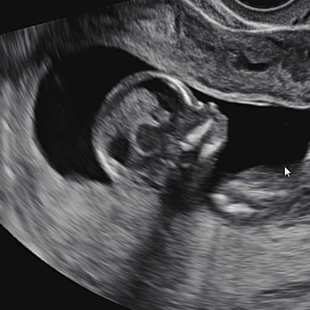 #15주차 #임밍아웃🤰🏻 

결혼하구 1년동안 
포항와서 살다가 순천에서도 살아보고
여기저기 놀러다니며 남편과 신혼 실컷 재밌게보내다보니
귀여운 아기천사가 찾아왔어요 👼
태명은 봄에와줘서 뽐이랍니다❤️
그동안 입덧때문에 힘들어서 인스타도 잘 못봤었는데 
다행히 안정기들어서니 괜찮아져서 
피드도 다시 올려보겠습니당🥰