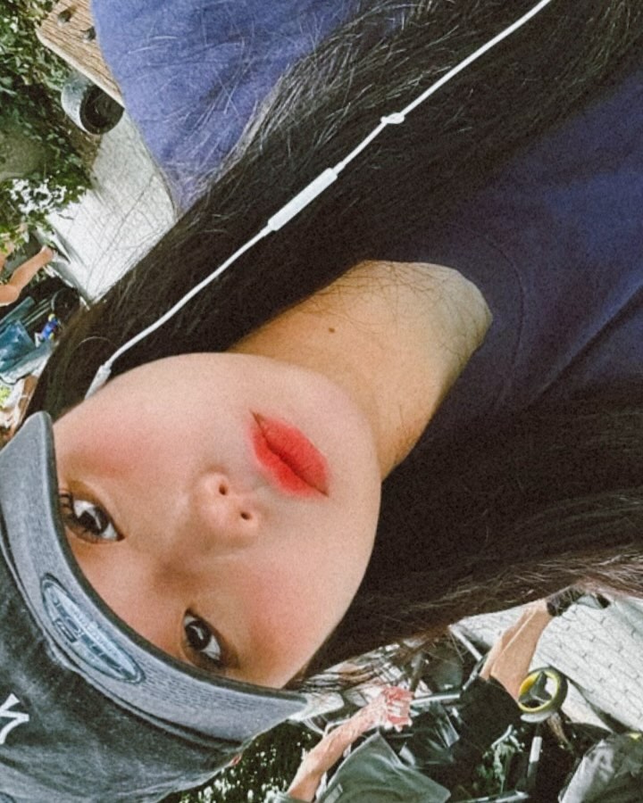광합성 과다 🍎