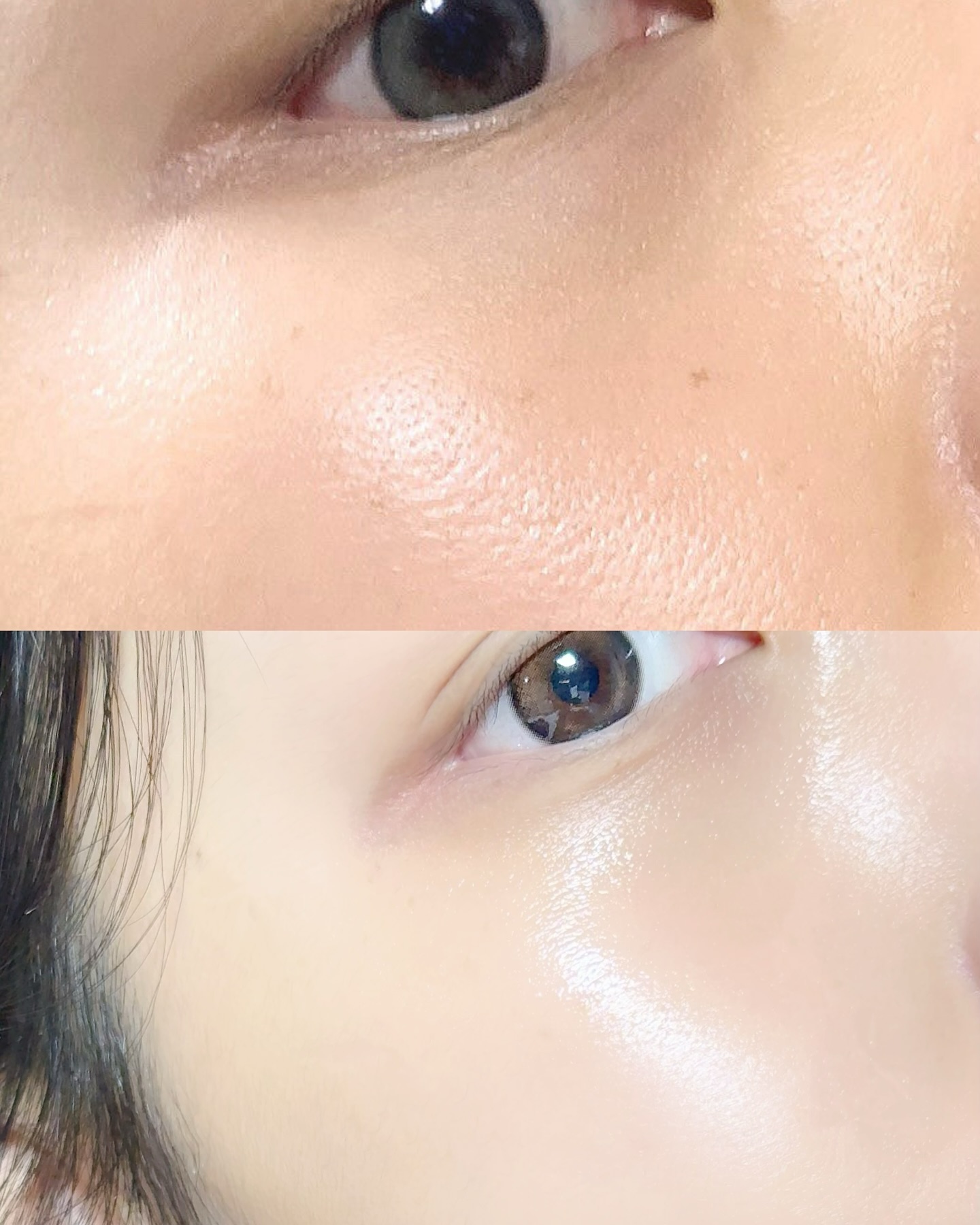 #협찬
missha.official 
애프터바캉스 모공관리엔 이거라고 마지막으로 말한다,,
레티놀 좋다는거 실감 못했거든요? 근데 이거 진짜 미쳤음
💜💜미샤 보라티놀💜💜

레티놀 그거 어머님들 쓰는거 아냐?
🙅‍♀️모공부터 피부결까지 케어해주는 성분이라
요즘 20대부터 슬로우에이징 관심있는 사람이면
집에서 다 쓰고 있음

요즘 핫한 스피큘에 스킨케어 장인 미샤의
독보적 레시피 #보라티놀 성분이 들어가서
늘어진 세로모공, 넓은 돌하르방 모공,
면적 축소 효과 인증받은 제품임

전 3주쓰고 효과봤어요
이건 빨리 시작하는 사람이 승자라니깐..?👍👍

#미샤 #MISSHA #미샤레티놀 #스피큘앰플 #찐모공축소세럼 #보랏빛레티놀 #타임레볼루션 #레티놀 #레티놀스피큘세럼 #레티놀크림 #레티놀500샷크림 #보들모공결크림 #코덕 #코덕맞팔 #뷰티인플루언서 #뷰티스타그램 #kbeauty #koreanskincare #韓国スキンケア #コスメレビュー #ベストコスメ2024 #ベストコスメ2024上半期