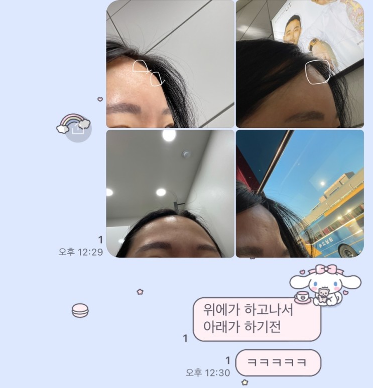 내 돈 내산 플래너 성형외과 이마 필러 (11월 05일) 이벤트가 5cc 20만 9천 원. . 솔직 후기! - 1탄