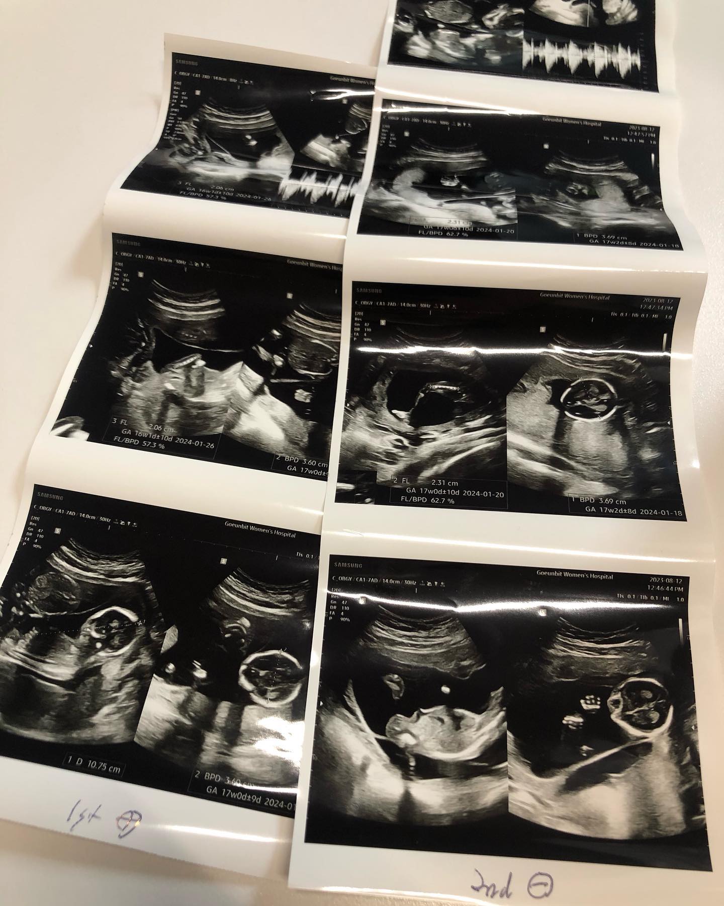 안녕친구들👶🏻👶🏻

오랜만에 다시 임신이라니
남은기간 탈없이 잘 지내보자❤️

#임밍아웃 #16주5일 #남매둥이 
#내가둥이맘이라니 #내가다둥이맘이라니🤦🏼‍♀️