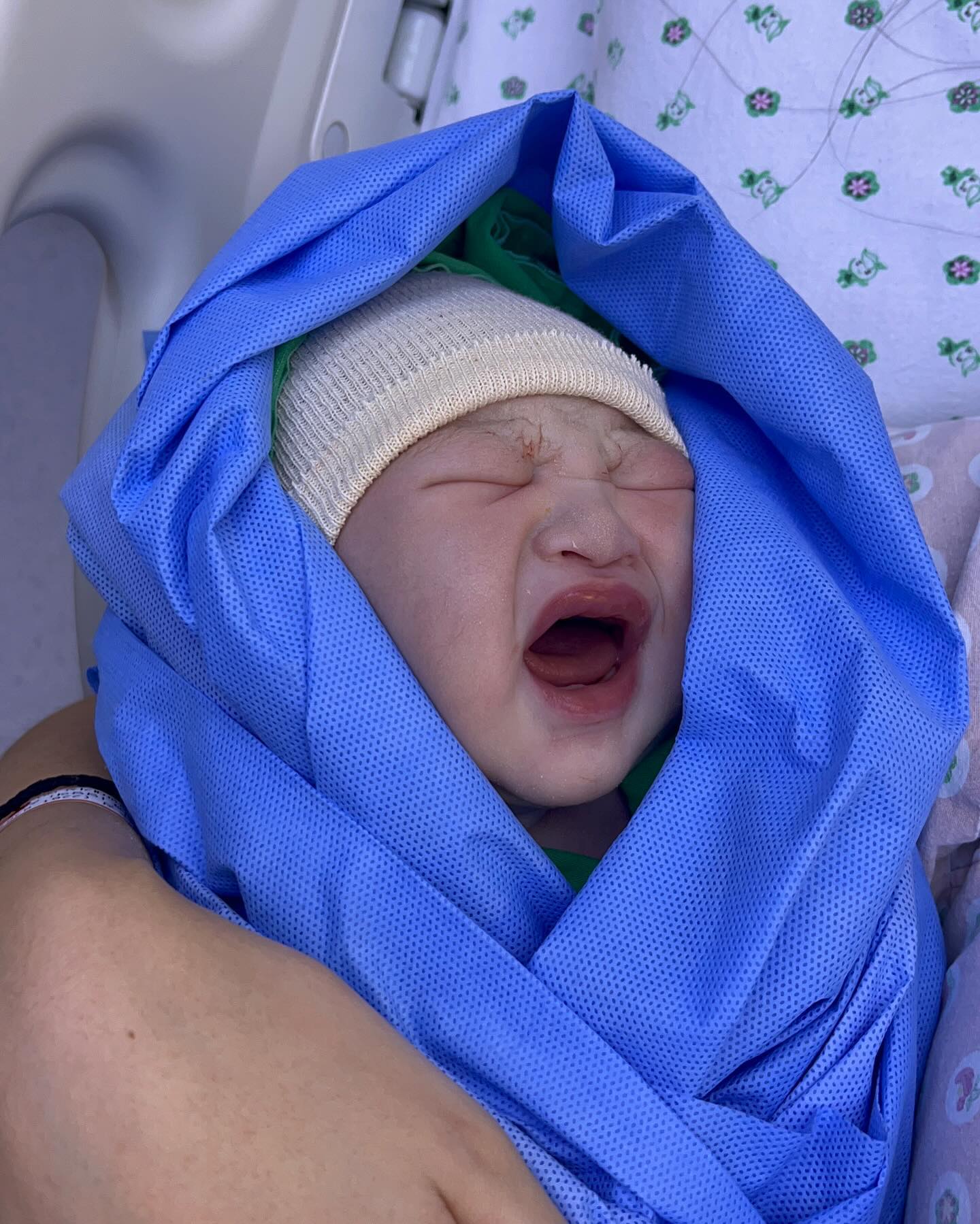 24.01.30 39w6d am10:49 3490g

#자연분만#자분#성공#5시간진통

나 살아있어오.,, 잊을 수 없는 분만과정,,,,
세상에 나온걸 환영해 우리쪼꼬미야
이따가 저녁에 보러갈께🥹❤️