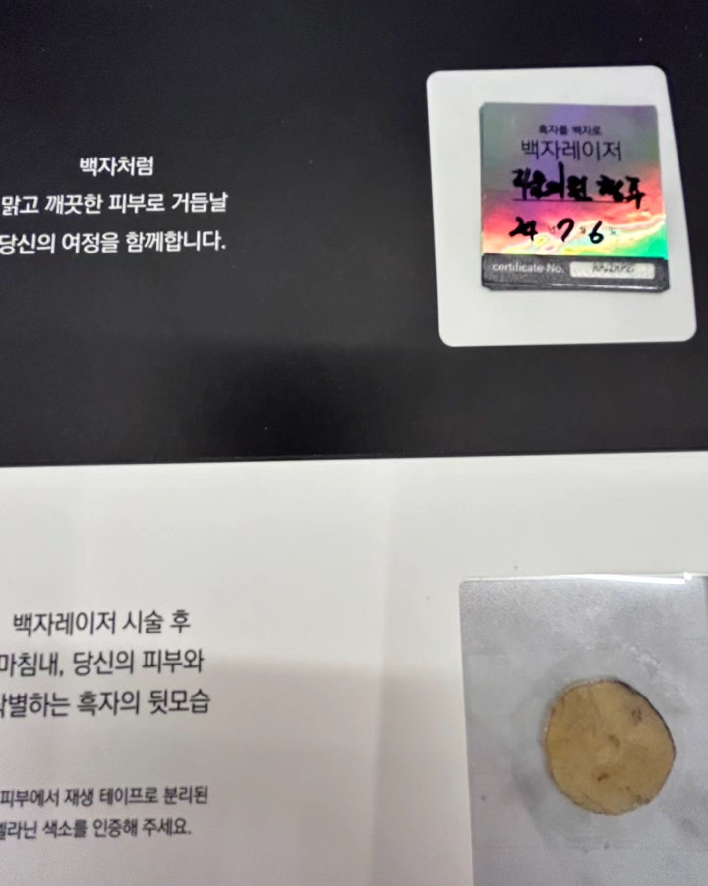 #협찬

더운여름ㅜ 아이는 놀이터에가고싶어하고 안갈수없어 땡볕 놀이터시간을 가졌더니..얼굴에 거뭇한 흑색반점이 많이 생겼더라구요😂
마침 백자레이저 (리팟레이저) 캠페인이 지금 진행 중이라 이렇게 참여해보았어요

팟레이저 1회 만에 깔끔하게 없어지는 레이저에요!
흑자제거의 경우 리팟레이저 1회 + 듀오덤 2주 부착하고 있어야해요~  듀오덤 2주 부착 후 떼면 흑자와 같이 떨어져나가는게 신기하더라구요!!
깔끔히 흑자제거하고싶으신분들께 추천드립니다!!

#백자레이저 #리팟레이저 #리팟 #reepot #백자레이저캠페인 #백자캠페인 #흑자 #흑자제거 #흑자 #검버섯 #오타모반 #잡티 #잡티제거 #밀크반점 #밀크커피반점 #커피반점 #카페오래반점 #주근깨 #얼굴착색 #색소침착 #색소치료 #색소질환 #피부과 #피부과시술추천 #피부과시술 #피부관리 #청주피부과