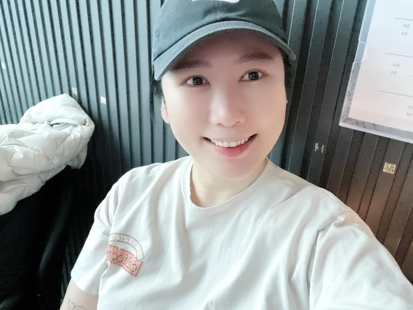 1~2주차 후기
-
사진순서 : 첫장 오늘 ㅋㅋ 뒷장은 과거부터 현재순 🫣
엥강하면 아이폰 기본 카메라, 아님 햇살버프, 종존 피부보정만!
-
-
처음 2~3일까지는 좀 부었음 많이 잘먹은것도 있는것같음,,,
순대국밥 못잃어,,, 한수저씩 쩍쩍 넣어먹음 🐷
-
1주일까지는 매일 거울보면서 이게 잘된건가? 
음? 조금씩 달라지고있는데? 음? 아닌가? 를 매일 반복
남편말로는 "나 어때?"를 입에 달고 살았다고함,,,,,,,,,,
6일지나니깐 오 뭔가 달라졌는데? 확 느껴짐
그전에는 코윗부분? 눈가가 확 펴져서 진심 개 행복했음
-
2주차가 되니깐 아랫부분이 라인이 잡히기 시작함
아래/위를 다른실로 다른 방법으로 해서 그런지몰라도
확실히 아픈거는 일단 잘 모르겠는데 묘하게 겁나 팽팽해짐
눈치빠른 회사 누군가가 얼굴에 뭐 했어? 팽팽하네? ㅗ
이지랄하길래 그냥 밤에 겁나 먹고 부어서 그렇다고함
이놈시끼들아 눈치챙겨,,,,,
-
하이에나 눈매가 많은 회사에서도 1명만 겨우 알 정도면 
회사다니면서 평일에 할만함 특히 굳이 땡김이를 하던가 
앉아서 자던가 이런거 없고 일상생활(운동은 원래 안해서 
모르겠고, 화장은 바로함)이 바로 가능하고
얼굴이 주름이 사라지니깐 나의 근심걱정도 사라지고 확실히
젊어보이는건 빼박인듯,,,, 진심 개쩔 ㅠㅠㅠ 
이래서 실리프팅못잃어,,,,,
-
아직 한달은 안되었지만 팽팽효과가 피부가 
좋아보이게하는것도 있는듯
난 왼쪽볼이 땅콩처럼 혼자 꺼져서 거기 살짝 필러 한방하니 
얼굴형이 예쁘게 잘 마무리된것같아서 좋았음!
-
다들 궁금해하는거!
처음에는 물론 아 'ㅇ' 크게 벌리면 실이 우두둑? 할지는 몰라도 사실 굳이 평소 생활처럼 생활하는데 무리없음 내가 가로로 
젓가락넣는거 아니면 뭐,,
아직 실터지는 느낌은 없었음 물론 일부러 크게 벌려는 봤는데 
멀쩡쓰 눈가에 필러나 보톡스 백날 맞아봤자 이거 하나로 싹 해결되니 개만족쓰 💙💙💙💙💙
2년후에 난 또 아마 실리프팅 후기를 쓰고있겠지,,,?
아! 시술은 듀얼피치리프팅+에그리프팅임 🙃
-
-
#저스트성형외과 #국경훈원장님 #실리프팅
#듀얼피치리프팅 #에그리프팅 #새얼굴로태어나자
#내_인센티브_얼굴에_몰빵🫢