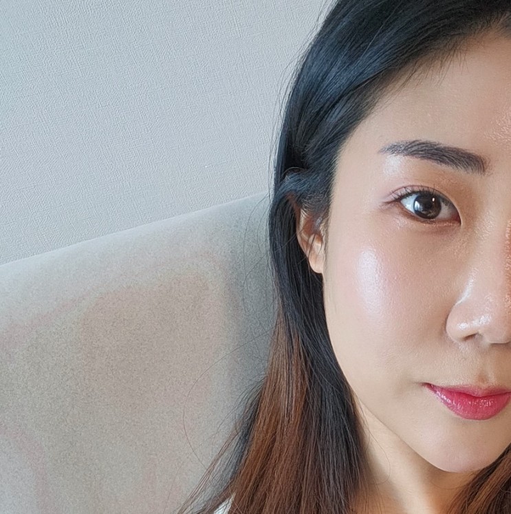 언주역피부과 스킨부스터 속건조, 홍조에도 좋은 리제반pn 솔직후기(통증,시술직후)