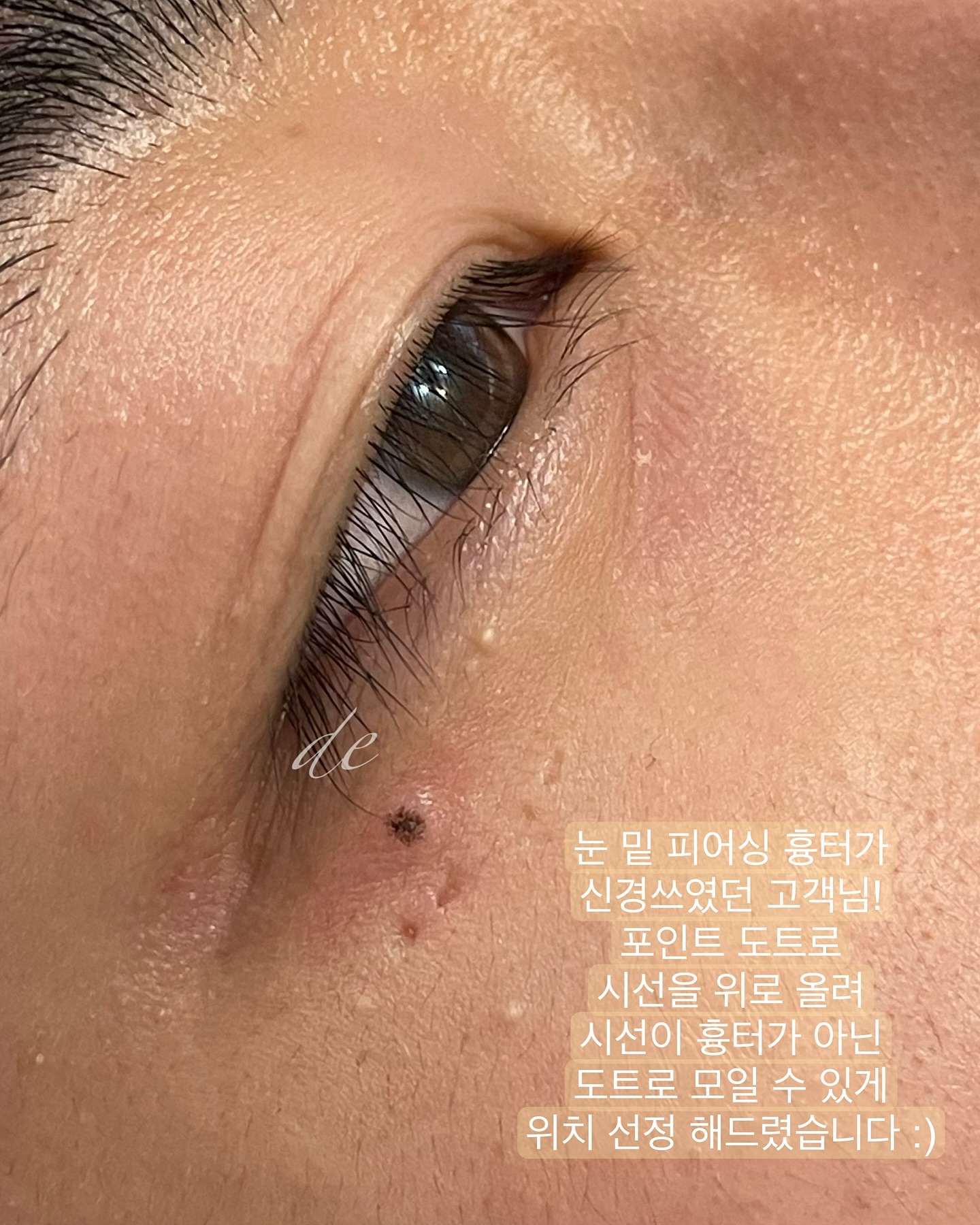 point dot 𖠌

요즘 남자분들에게 더 인기 많은 시술!
이런 퀄리티 시술 아무 곳에서 나 받을 수 없지요 :)

10분 내외로 짧은 시술 시간과
미인점, 복점, 커버업 등 여러 활용도가 좋거든요 😉
⠀

#부산미인점 #울산미인점  #울산점타투 #울산점 #경주미인점