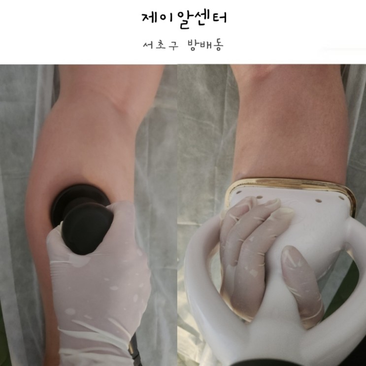 서초동 다이어트 제이알센터에서 하체관리 받고왔어요 :)