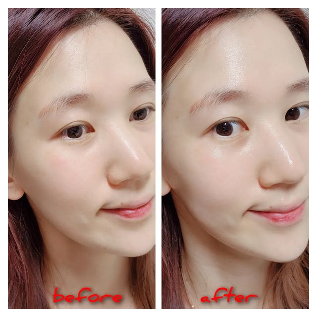 아린맘, 지원 on Instagram: "#광고 집에서도 에스테틱에 갔다온 것 처럼 촉촉하고 탱탱한 물광피부 완성~ 메디큐브 콜라겐 글로우 버블 세럼 사용했어용!😆 고함량의 11종 콜라겐 콤플렉스 함