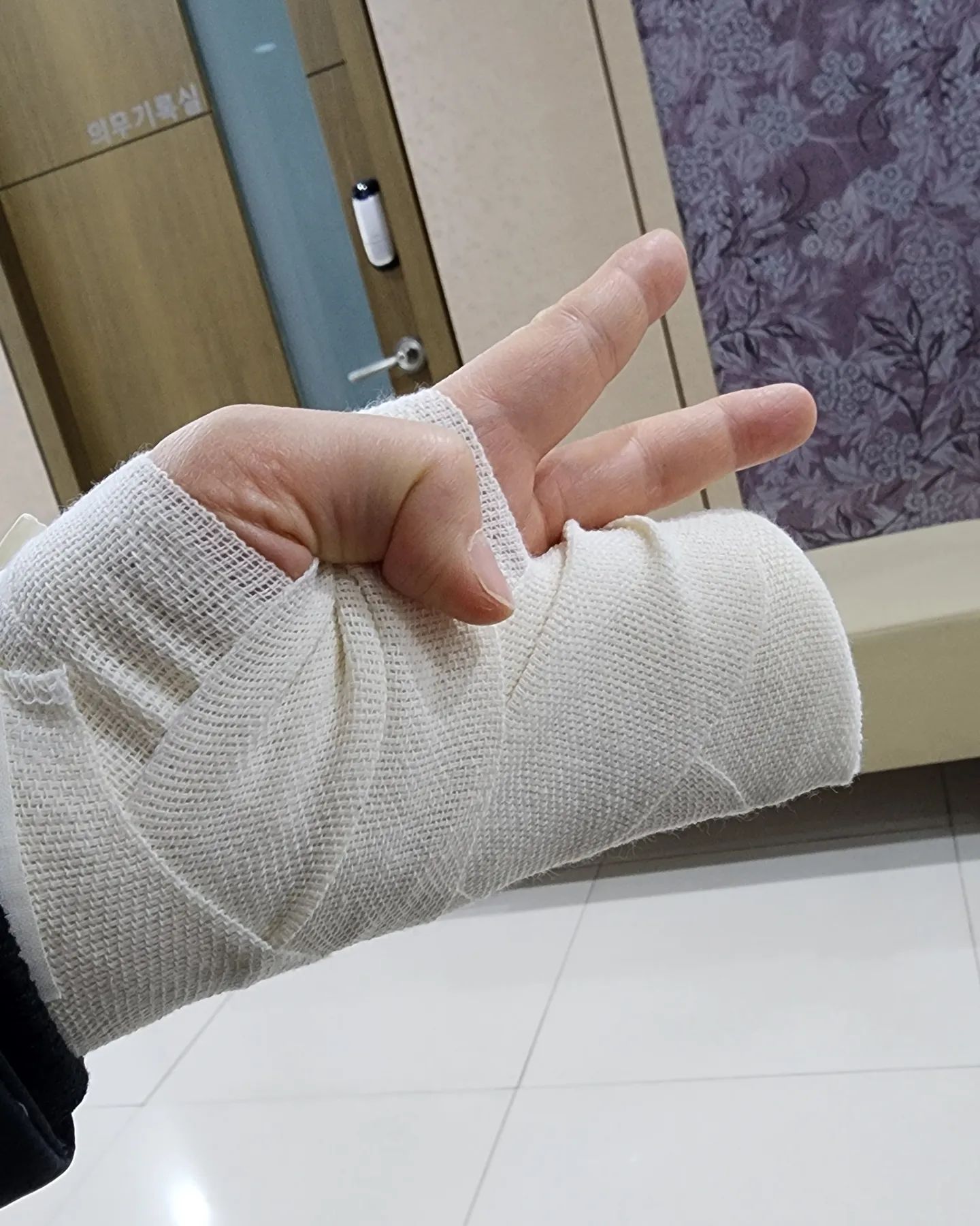손바닥 결절종.
몇 달 전부터 손바닥에 알갱이가 만져지고
통증도 있어서 정형외과 왔다가
바로 시술받고 제거 함.
주사기로 꾹 찔러서 짜냈는데 
쌀알보다 조금 큰 투명한 알갱이가 나왔다.
제거를해도 재발 가능성이 있단다.
손을 많이 쓰지 말라는데... 어떻게 그러지?ㅋㅋ 

#손바닥결절종 #결절종 #결절좀제거 #재발가능성있음