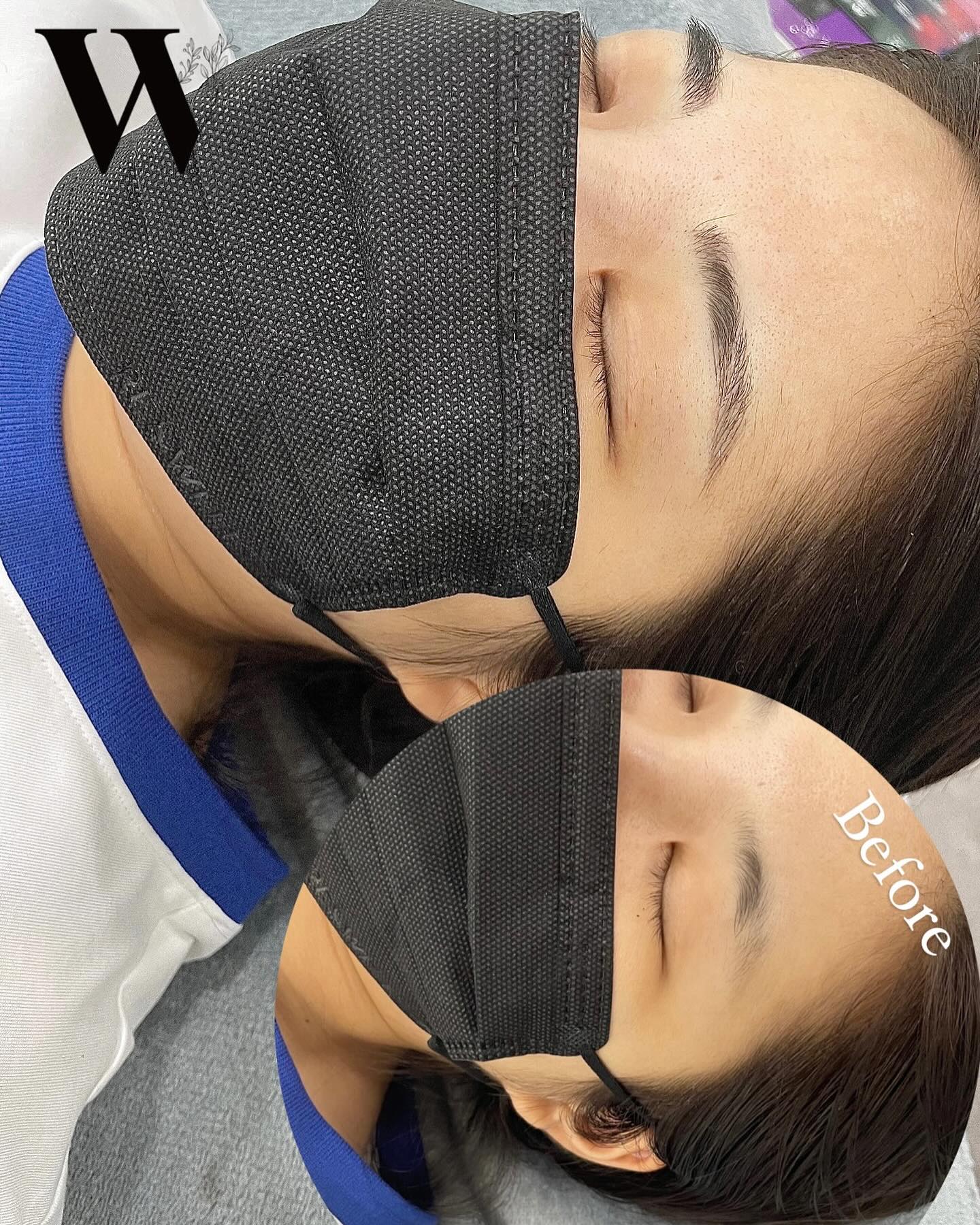 ___❝Wooah brow❞

:고객님의 니즈에 맞춰
모든시술이 들어갑니다!
그냥 누우세요~가 아니라
상담실에서 꼼꼼하게 상담한 뒤
디자인도 그려보고 시술

울산에서 눈썹 제일 잘하는 곳은
우아뷰티

#울산북구눈썹문신 왜 고민하세요!
#울산중구눈썹문신 도 #울산남구눈썹문신 도!
#울산동구 에서도 많이 찾아온답니다 🤍

#울산반영구수강 맛집
#눈썹 맛집 #울산우아뷰티