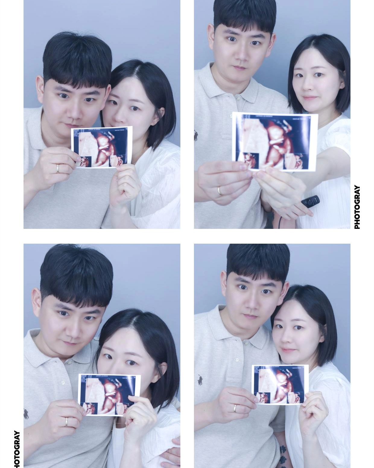 엄마가 되었어요!🤰👶💕 (20w2d)
오늘 니프티 결과도 모두 저위험군 나와서 다행이고 :) 
하루하루 쑥쑥 커줘서 고마운 찰떡이!😇
#임밍아웃#아들맘#나에게와줘서고마워