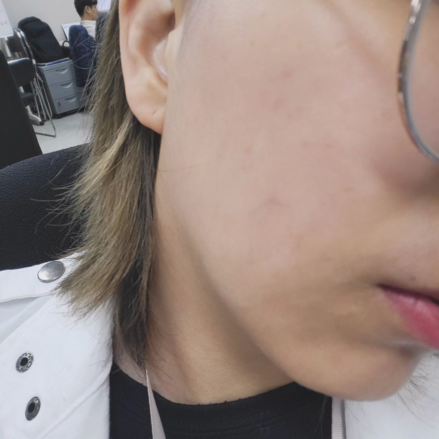 #협찬

호르몬파티+피로로 인해서 이상하게 좁쌀트러블이 올라오기 시작했다. 팩도 해보고 깨끗하게 세수도 했는데 뭔가 허전한 느낌이 들어서 강력처방으로 집중케어 앰플을 발라보았다.
#락토클리어 #블레미쉬클리어스팟앰플 

가벼운 제형으로 수분크림이나 스킨케어랑 섞어서 사용하기도 좋고, 케어가 필요한 부위에 국소적으로 사용할 수 있고 크기도 아담해서 가방에 쏙쏙 넣어다니기도 좋당 ㅎㅎ 맨날 답답한 패치 붙이다가 간편하게 앰플만으로도 케어가 되니 세상 넘나 편한것~ 피부자극테스트와 여드름성피부사용 테스트도 받은 제품이라 민감성 피부도 안전하게 사용가능해요! 피지컨트롤과 진정을 함께 할 수있는 제품을 찾는 분들에게 추천합니다 ㅎㅎ

#트러블
#집중케어
#여드름
#여드름없애는법
#여드름피부관리
#여드름케어
#여드름원인
#얼굴트러블
#트러블케어
#좁쌀여드름화장품