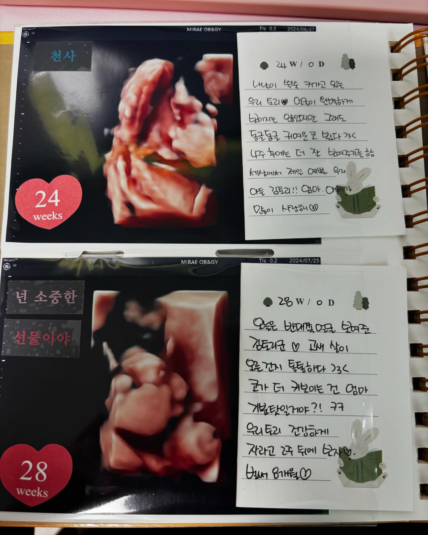 사랑하는 김토리👶🏻❤️
8개월차에 접어들다ㅏㅏ
와우 벌써 8개월
10월 중순 예정이었는데 
10월 초에 나올지도 모르는 김토리군

오늘은 얼굴 잘 보여달라고 초코우유까지
냠냠하고 갔는데.... 
탯줄이 앞을 가려버렸네 흙흙

어째 살이 통통하게 오른 거 같다 ㅇㅁㅇ... 
엄마도 찌는데 너두 찌구 있는거지?!?!
2주후엔 더 예쁜 모습 보여줘 우리 아들👶🏻

근데 토리야...
엄마 정면 얼굴 보고시펑
2주 후엔 정면 좀 보여쥬ㅓ엉 
사랑해 우리 이뿌닝❤️👶🏻