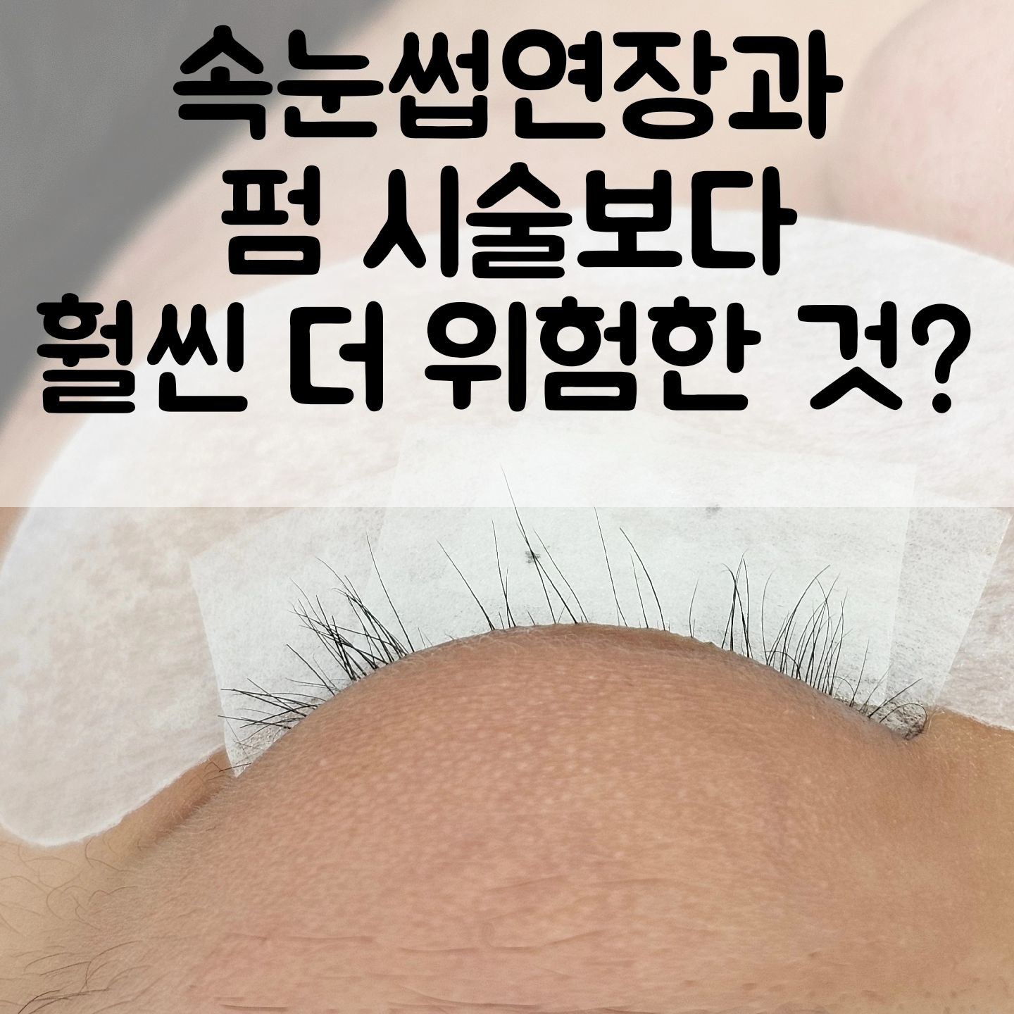 📌 속눈썹연장 또는 속눈썹펌을 하면 
속눈썹 다 뽑히고 상한다고 하던데요? 

이런 편견 갖고 계시는 분 많이 봤는데요😅

속눈썹연장이나 펌 같은 시술로 속눈썹이 상하는거보다
매일 사용하고있는 뷰러가 몇배는 더 
속눈썹을 상하게 하고 다 뽑히게 합니다 😢

속눈썹펌 하면 속눈썹 상할까봐
뷰러를 매일 쓰셨나요?

뷰러사용으로 인해 속눈썹 잘림과 뽑힘 등의
손상과 악순환이 훨씬 더 강합니다.

사진은 단 한번도 속눈썹 시술 받아본 적 없고
뷰러만 사용하다가 더이상은 뷰러로 찝히는 속눈썹이 없어서
친구들의 권유로 펌을 해보려고 오신 고객님이신데요.

연장이나 펌 같은 시술 받아본적 없는 속눈썹인데
오로지 뷰러 사용만으로 속눈썹 상태가
이렇게 됐습니다😭

펌을 할 속눈썹이 없어서 펌은 불가능했고
그나마 연장으로 가볍게 커버해서
관리 해드렸는데요

제발 제발 뷰러는 절대로 사용하지 마시라고
부탁을 드렸습니다😭😭

뷰러 한번 하는것보다
펌 열번 하는게 더 나아요ㅠㅠ

집에 있는 뷰러
당장 쓰레기통으로 고고!!