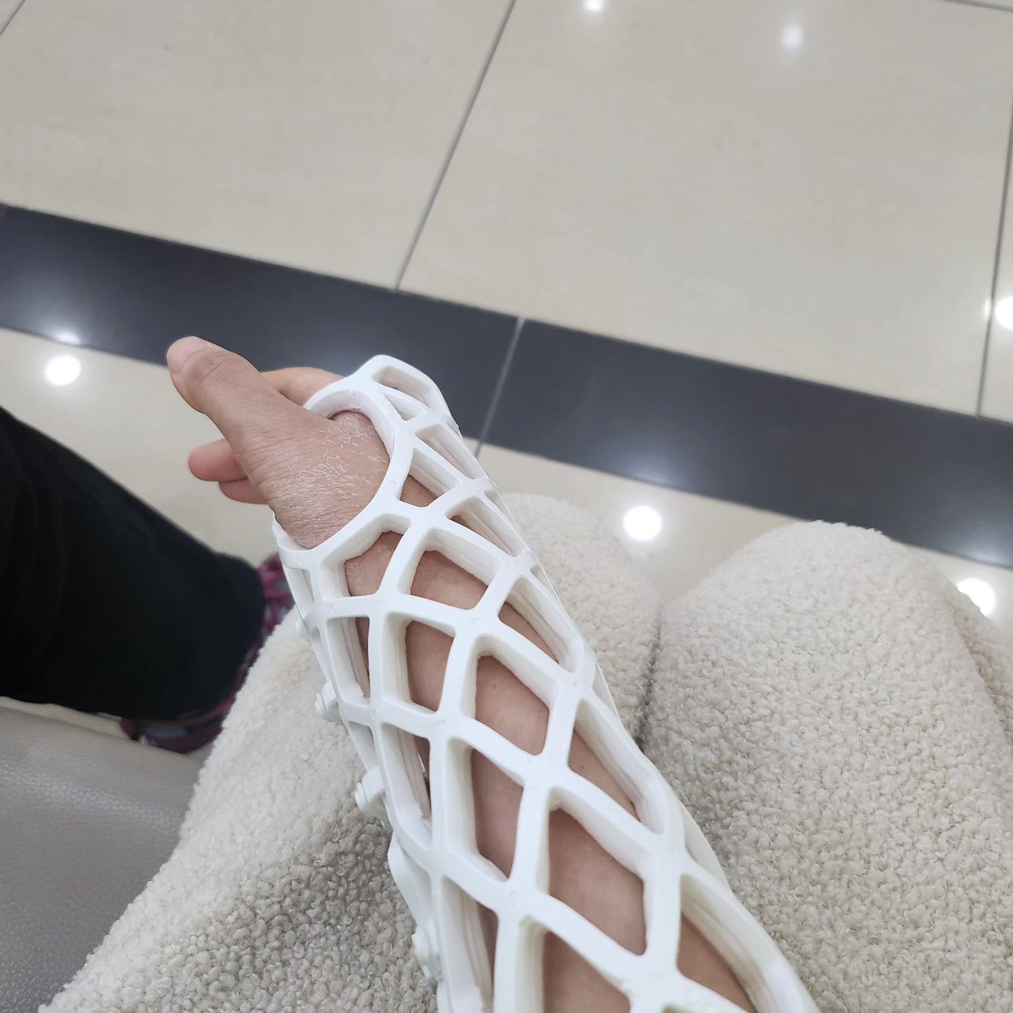 터미네이터 팔같음
낼부터 씻고 4주뒤 재활