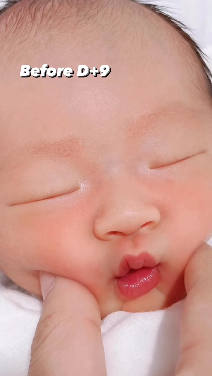작년 22년 6월 4일 태어난지 9일째 되는날 하빈이와
딱 1년후인 23년 6월 4일의 하빈이의 비포에프터🤭
⠀
앨범을 보다 발견한 1년간의 변화가 너무 신기하다💕
⠀
⠀
⠀
#비포 #에프터 #비포에프터 #before #after 
#성장기록 #성장사진 #육아일기 #육아기록
#12개월아기 #아들육아 #릴스타그램 #아기릴스 
#baby #cutebaby #babyboy #growth