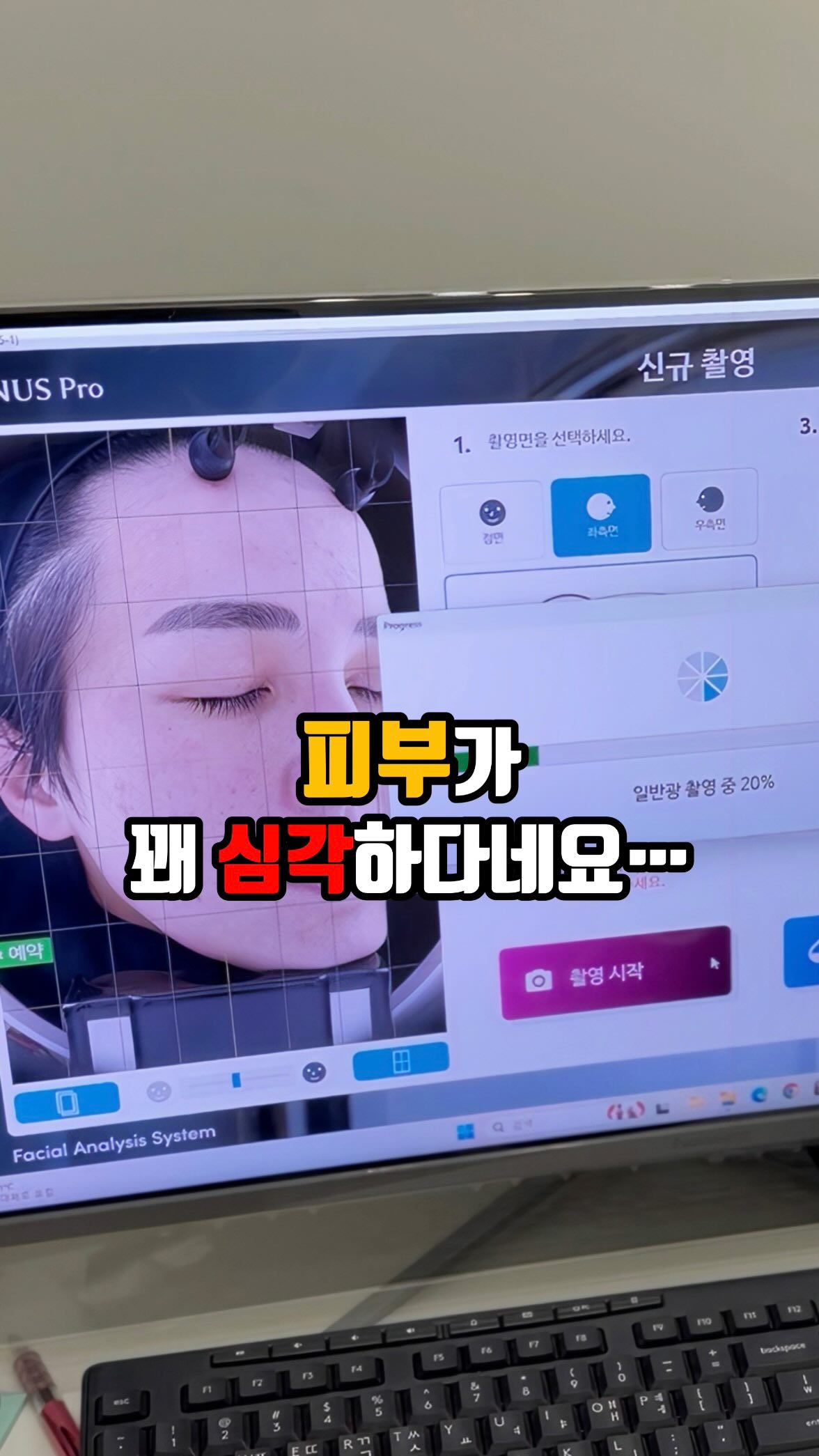 콘텐츠