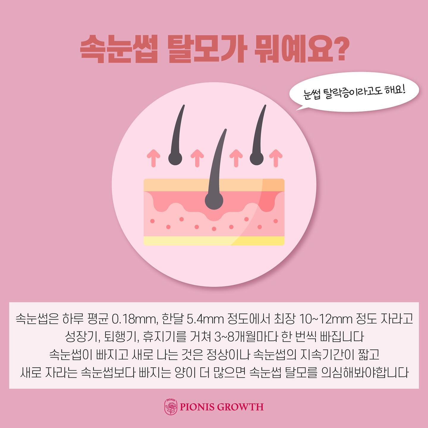 속눈썹 탈모가 모야모야?!

속눈썹 하나만으로도 인상이 달라져 보이는거 아시죠?
그래서 우리가 속눈썹 펌도 하고, 연장도 하자나용?

요즘 펌 시술 할 때 보면,
많은 분들이 속눈썹 탈모증상을 가지고 계시더라구요

그래서,!!!
속눈썹 탈모가 고민이신 분들!

어떻게 하면 개선시킬 수 있나요🤗

➡️ 피오니스로 속눈썹 모를 건강하게 해주며
모발 성장에 필요한 영양을 공급해주어
모발이 굵고 진해지고 풍성해지는 관리를 합니다
➡️속눈썹 뿐 아니라 두피,헤어라인,눈썹 등 모발 성장을
원하는 모든 부위에 관리 가능🅾️

🫶🏻일반 MTS기법 ❌
🫶🏻특허성분을 포함하여 모발성장의 핵심요소를 모두 담아
모발 성장을 촉진시켜 빠르고 굵고 진하고 풍성하게~
🫶🏻일상생활 바로 가능➰

⚫️ 독보적인 기술을 가진 피오니스 생장케어는
공식 대리점인 “페르레이뷰티”에서💛

관련 문의 및 상담 언제든지 환영입니다💋

#생장술 #속눈썹생장술 #모발생장술 #두피생장술 #피오니스생장술 #대구속눈썹생장술 #탈모관리잘하는곳 #대구탈모관리 #대구생장술 #달서구생장술 #달서구탈모 #탈모생장술 #생장세럼 #속눈썹생장술수강 #속눈썹생장제 #피오니스그로스 #피오니스대리점 #페르레이뷰티