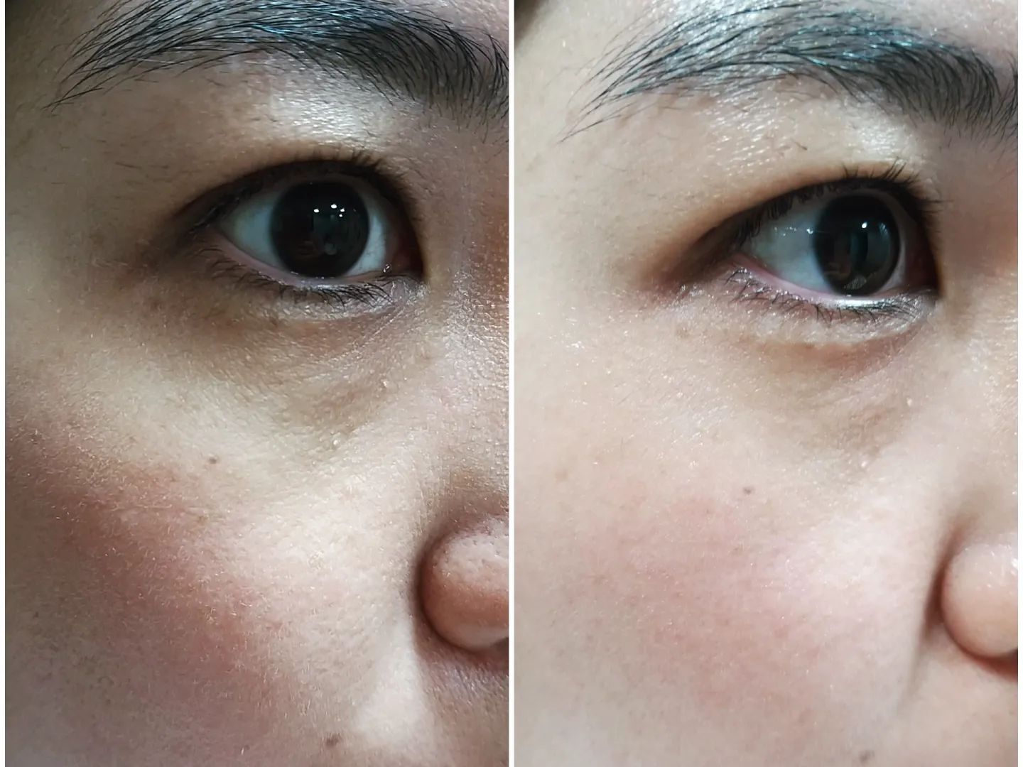 #협찬
가을이라 건조해서 화장 뜨는 분들을 위한 특단의 조치 알려드릴게요.
저는 1년 365일 #화이트트러플 이 함유된 #달바로얄세럼 으로 건조한 피부에 생기를 불어 넣습니다.
#달바세럼시즌5 는 비건 인증 콜라겐 추출물이 765000ppm으로 피부 탄력에 도움을 주고, 글루타티온도 함유되어  항산화까지 관리할수으니, 두 마리 토끼를 다 잡은 제품이라고 할수있어요.
주위에서 피부 광채 난다고 #미스트추천 해 달라고 하면 전 항상 이 제품을 추천합니다. 향도 아로마틱 시트러스 플로럴 향으로 누구나 호불호 없이 좋아하더라고요. 또 휴대성이 간편해서 가지고 다니면서 언제 어디서든 건조할 때마다 뿌려 주면 광채 피부 완성입니다. 토탈 항상화세럼으로 토너, 미스트, 세럼, 에센스를 한번에 케어 할 수 있으니 더 좋아요.
ㆍ
ㆍ
#세럼추천 #미스트세럼추천 #항산화세럼 #비건세럼 #달바미스트세럼 #피부미인 #피부건조 #화장뜸
dalba_piedmont
