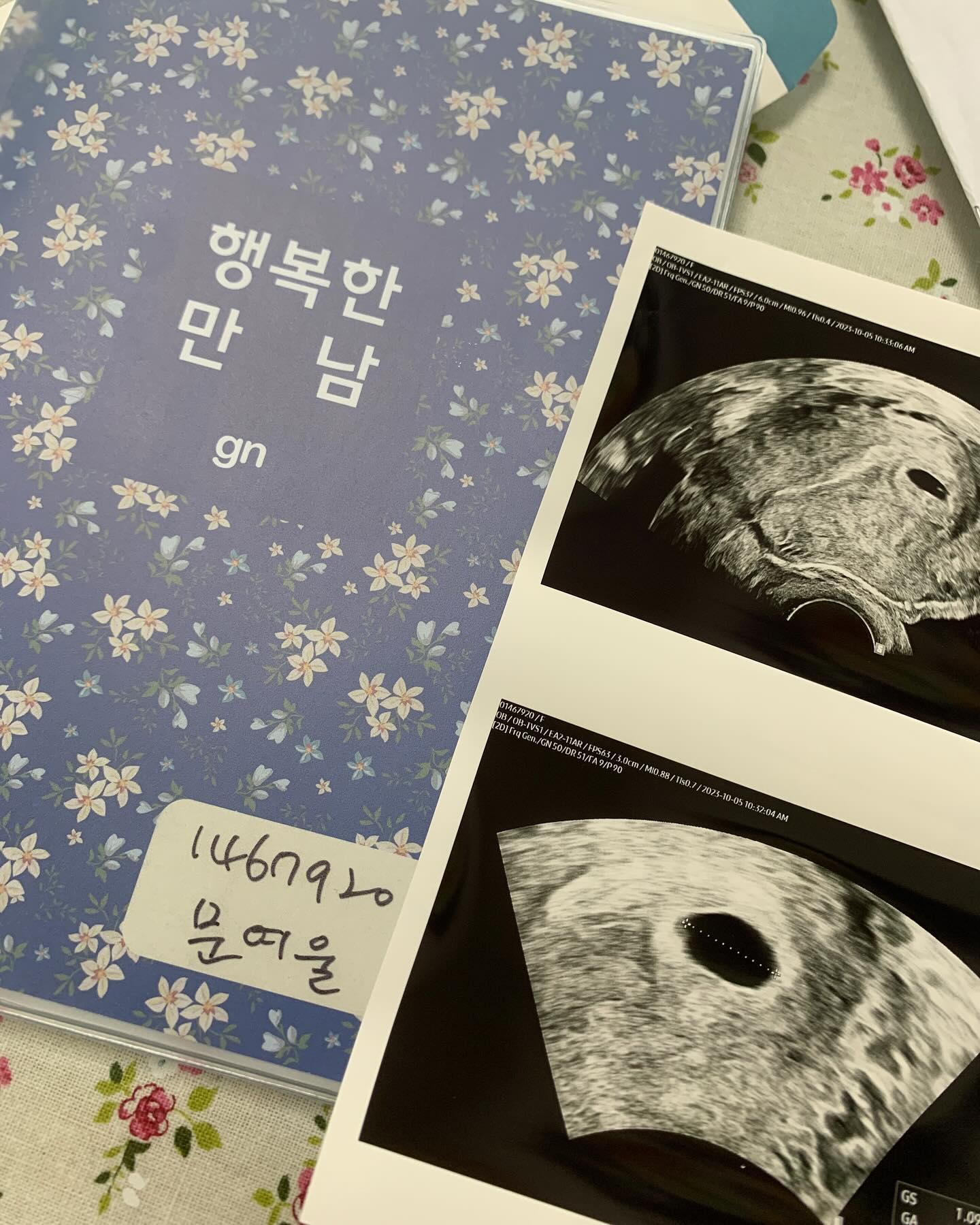#임밍아웃#14주차
우주동생 ‘우동’이를 소개합니다....ㅎㅎ
.
.
추석 전 두줄을 확인하고 혼자 입이근질근질 한걸 참고....치앙마이한달살기를 계획했던 지라 가야하나 말아야하나 고민도 잠시했지만 여행에 미친 엄마를 따라 치앙마이,일본 총 5번의 비행에도 잘 자라고 있는 튼튼한 우동이❤️
.
둘째라서 별로 감정없을 줄 알았는데 우리오빠 눈물글썽에 나도 글썽🥹행복하자 우리네식구😍
.
.
오늘 진료보러갔는데.... 다리사이에 또 뭐가보이넹.. 너도 아들이구나.......상관없어..아니야..상관있어......🥲
성별반전을 꿈꾸며 쓰는 나의 임밍아웃일기🫶