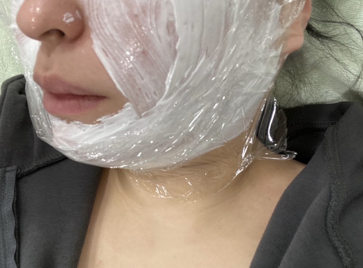 광주피부과 텐써마 처음해봤는데 찐 얼굴 작아진듯