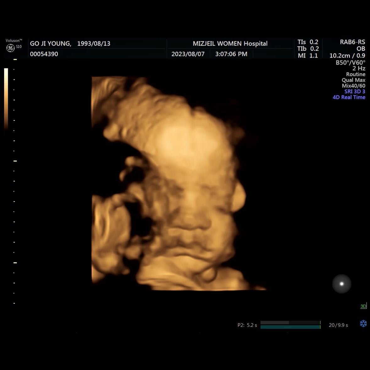 처음으로 삼안이 얼굴 본 날 👶🏻

10월에 만나자 삼안아👋🏻

#30w3d