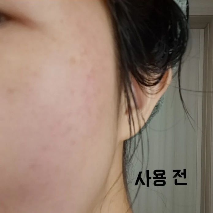 #협찬 #제품제공

나는 얼굴에 붉은 여드름?과 피부가 건조해 수분이 하나도 없는 피부이다.
매끈하고 요철없이 수분감 넘치는 피부를 가지고 싶어 검색하던 중 찾은

피부 분비량, 붉은기, 장벽 고민 모두 해결해주는 
💚 편강율 얼티밋 진정 솔루션 3종 💚
〰️ 국내외 독점 한방성분으로 문제성 피부에 탁월
〰️ 데일리 진정 수분 케어에 탁월
〰️ 여드름성 피부 사용 적합 임상 완료된 제품
〰️ 사춘기 10대 청소년, 성인 여드름, 특히 화농성 여드름 등에 효과

✅ 모든 문제성 피부의 원인은 피부열! 
얼티밋 라인의 주 성분인 💚A.C.C 성분은💛 
쿨링 원료로 피지 분비 및 피부 온도를 빠르게 감소해주어
지성 피부이신 분들의 인생 스킨케어템

약 1주일동안 토너, 세럼, 크림 얼티밋 3종을 꾸준히 사용했더니 
세상에 👀 붉은기가 줄어들더니 피부가 촉촉한 것은 물론 환해지기까지해
너무 놀라웠다 🧡

📍얼티밋 사용 TIP ! 📍
✔ 세안 후 물기가 없는 피부에 토너를 적당량 발라주거나 화장솜을 이용해 피부를 부드럽게 닦아준다.
✔ 붉은기가 심한 나는 화장솜보다 손에 소량 덜어 여러 번씩 흡수시켜줬다. ⚠️ 한 번에 많이 바르는 것보다 소량을 여러 번 덧발라주면서 피부에 
흡수할 때 효과가 더욱 좋았다.

🏷 pyunkangyul
➡️ 출시기념 20% 추가할인, 제품 무료체험 이벤트 중!
 후기가 좋은 검증된 제품인데 안 쓸 수 없겠네요💛

#피부좋아지는법 #여드름화장품 #화장품추천 #지성피부 #인생기초 #인생스킨케어 #스킨케어루틴 #편강율얼티밋 #얼티밋앰플 #수분크림 #수분크림추천 #세럼추천 #편강율 #여드름화장품