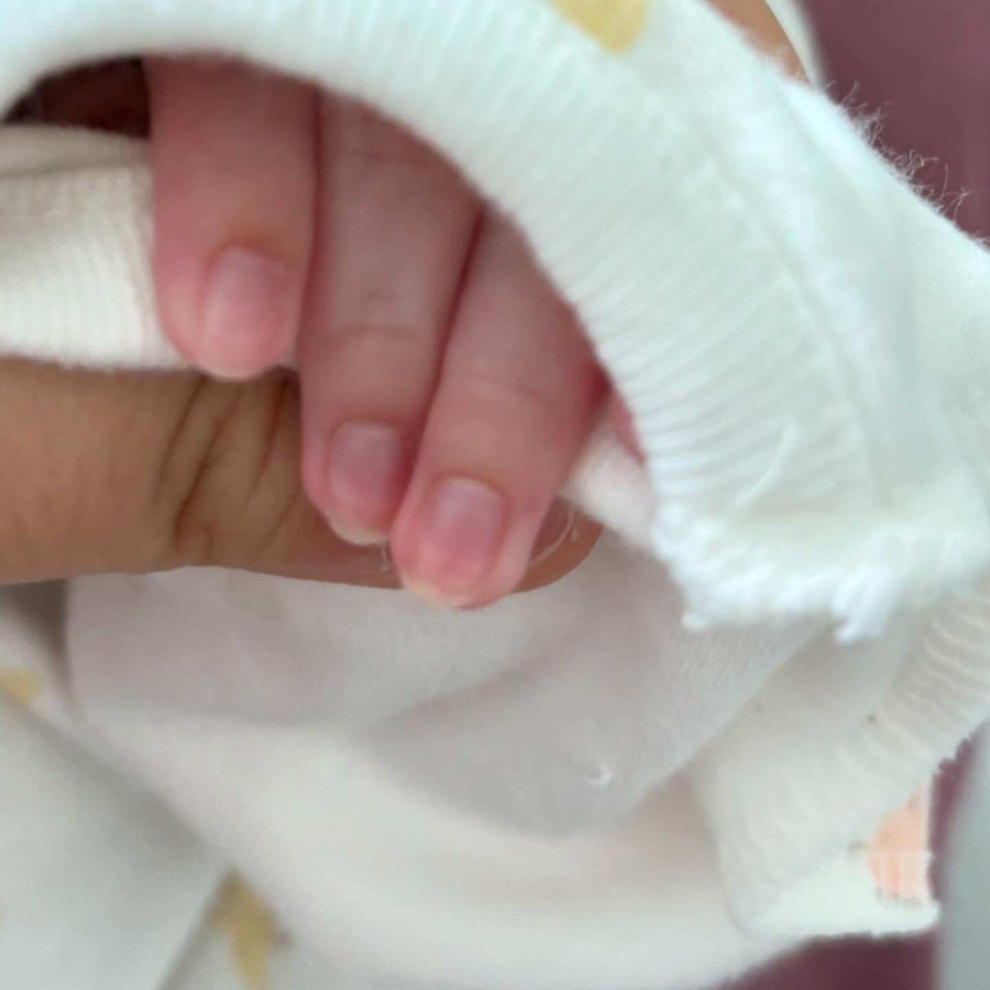 귀염뽀짝 미니미 손꾸락 발꾸락
이르게 태어난 내 미니미
배속에서 더 품고 있어야 하는데 빨리 세상 밖을 나오고 싶어하는지 3주 남짓 빨리 나와서 또래 아이들보다 작지만 그래도 현재는 건강하게 하루 하루 나는중.
벌써 오늘로 31일차.
인생 한달차..

현실 육아에 잠도 못자고 나도 햇빛 못본 지 벌써 한달..이 되었지만 그래도 좋아.
남들보다 순하단 말에 힘입어서 오늘도 힘을 냅니다.

#육아스타그램 #육아중 #일상스타그램 #출산 #임신 #아기계정따로