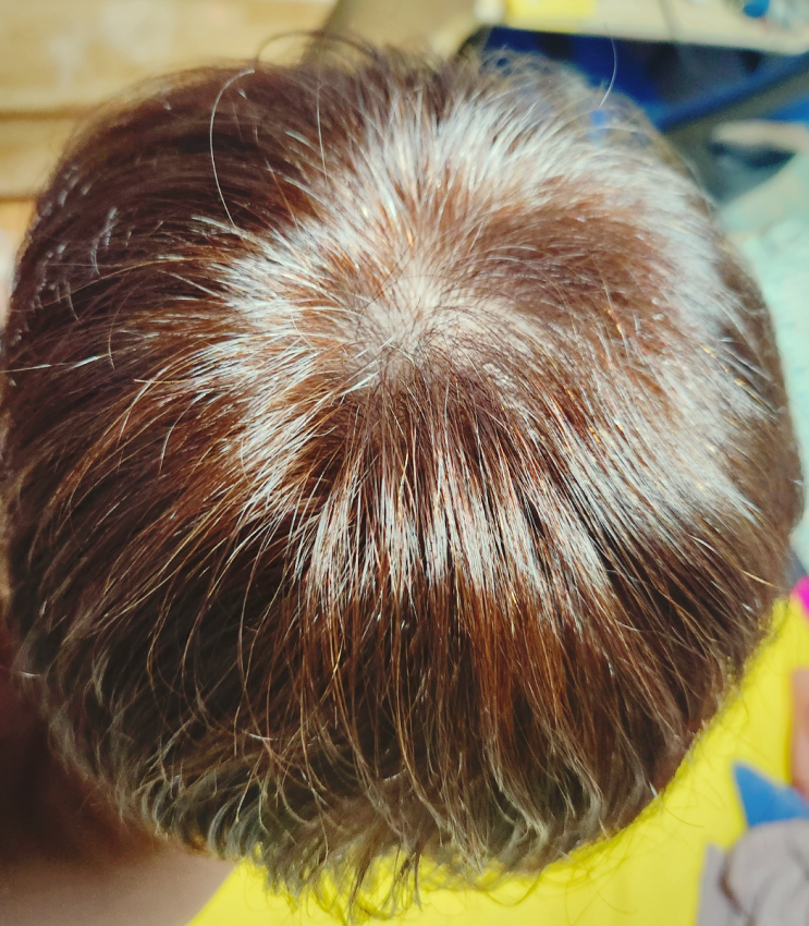 셀프 염색, 브라코스트 염색약으로 자극 없이 엄마 머리 염색하기! 새치 염색약 추천