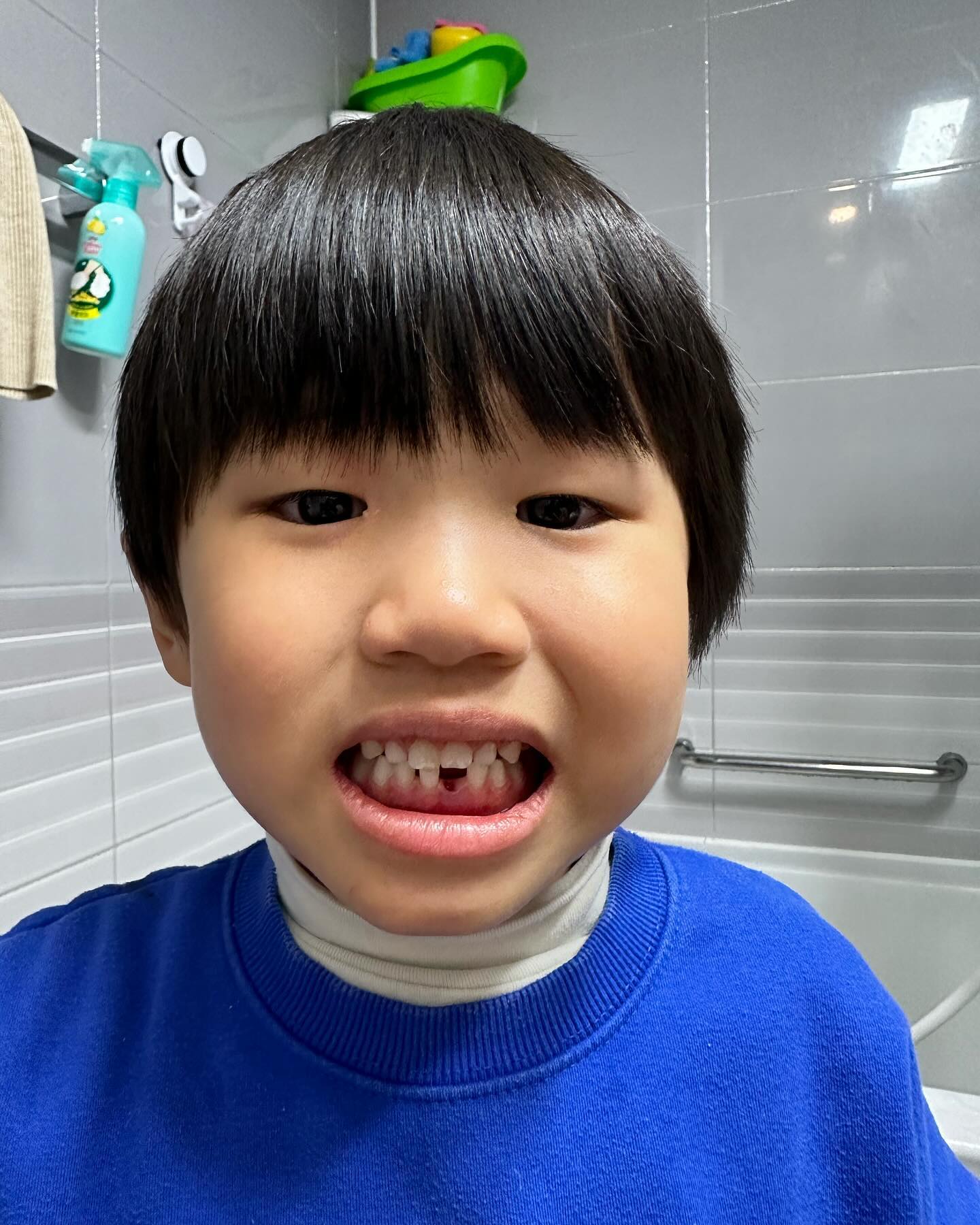자몽이 첫 유치 빠졌어요😭😭